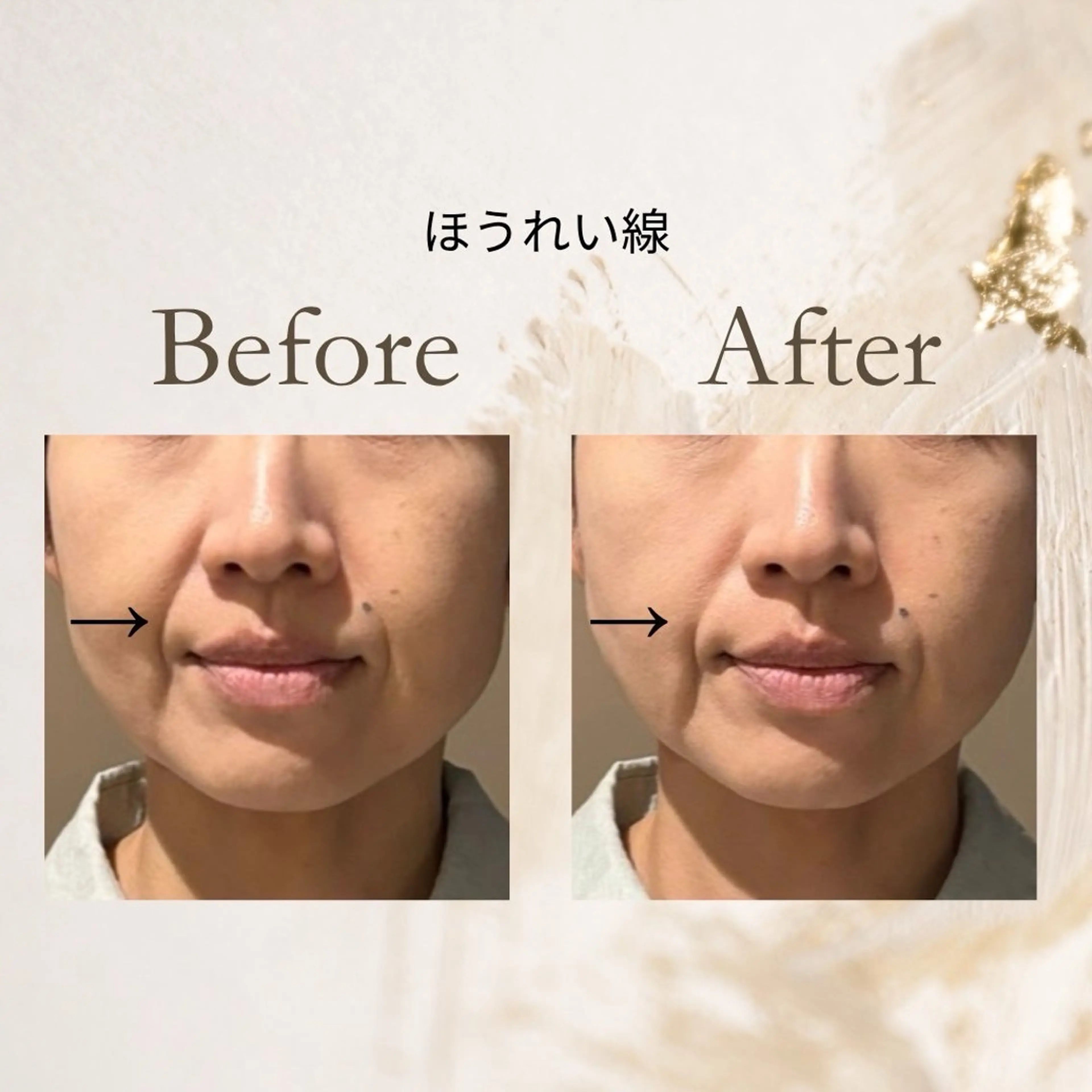 健康×美容鍼鍼灸院 あさば整体院三ノ輪店のエステ・リラクイメージ