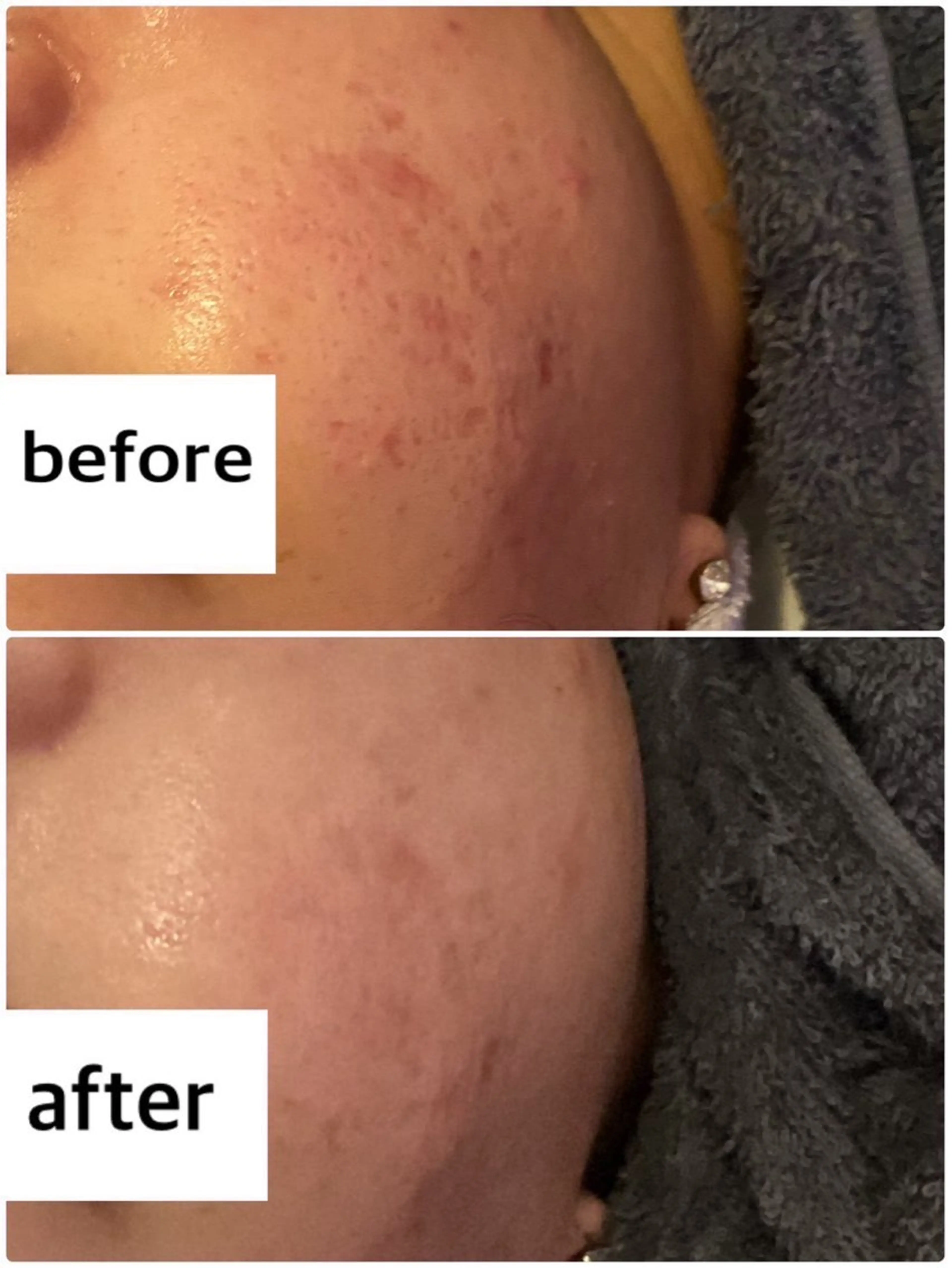 エステ 韓国肌管理 Belleのエステ・リラクイメージ