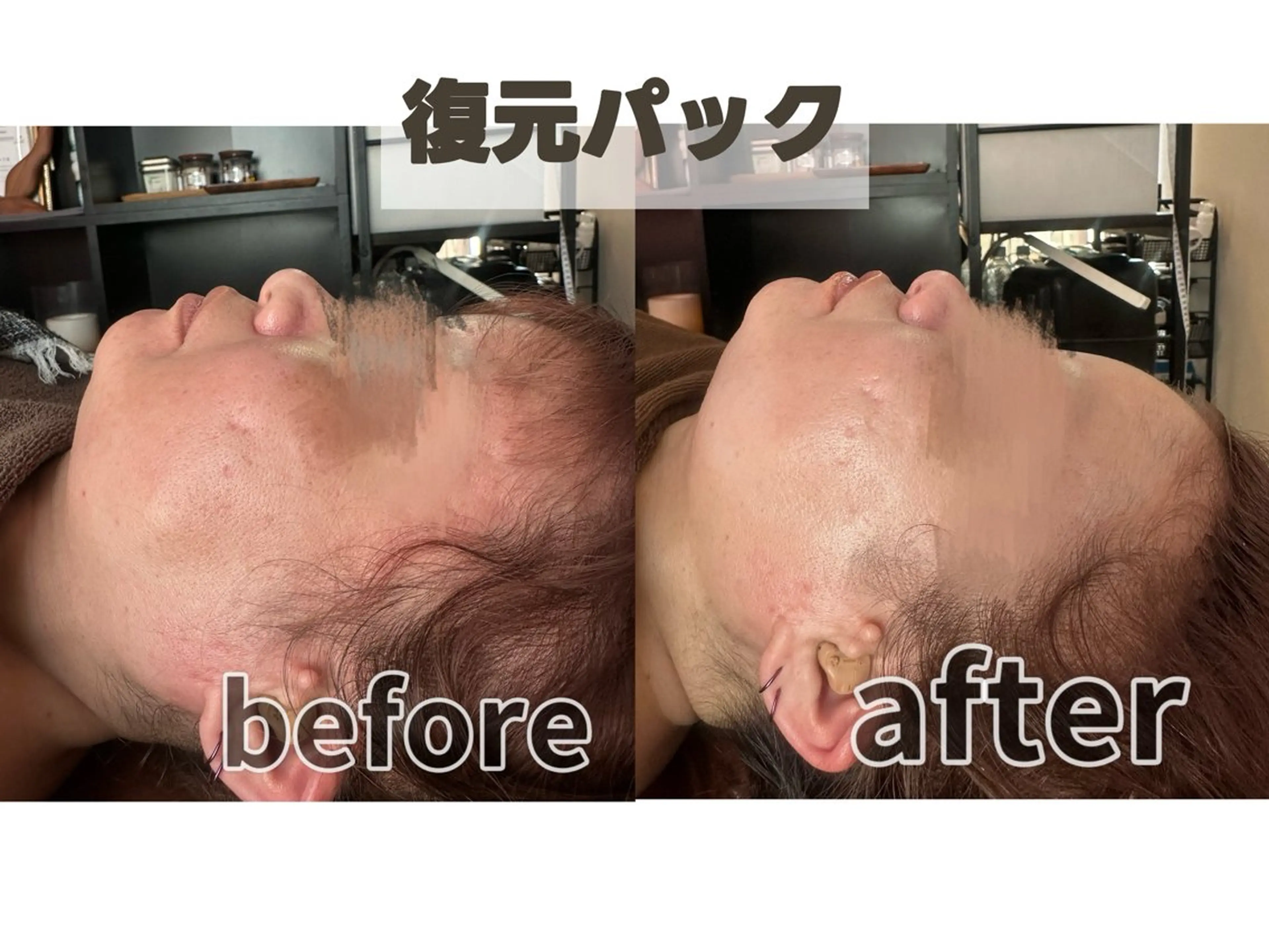 エステ 浮腫|肩こり|張り 日々の疲れを解消★のエステ・リラクイメージ