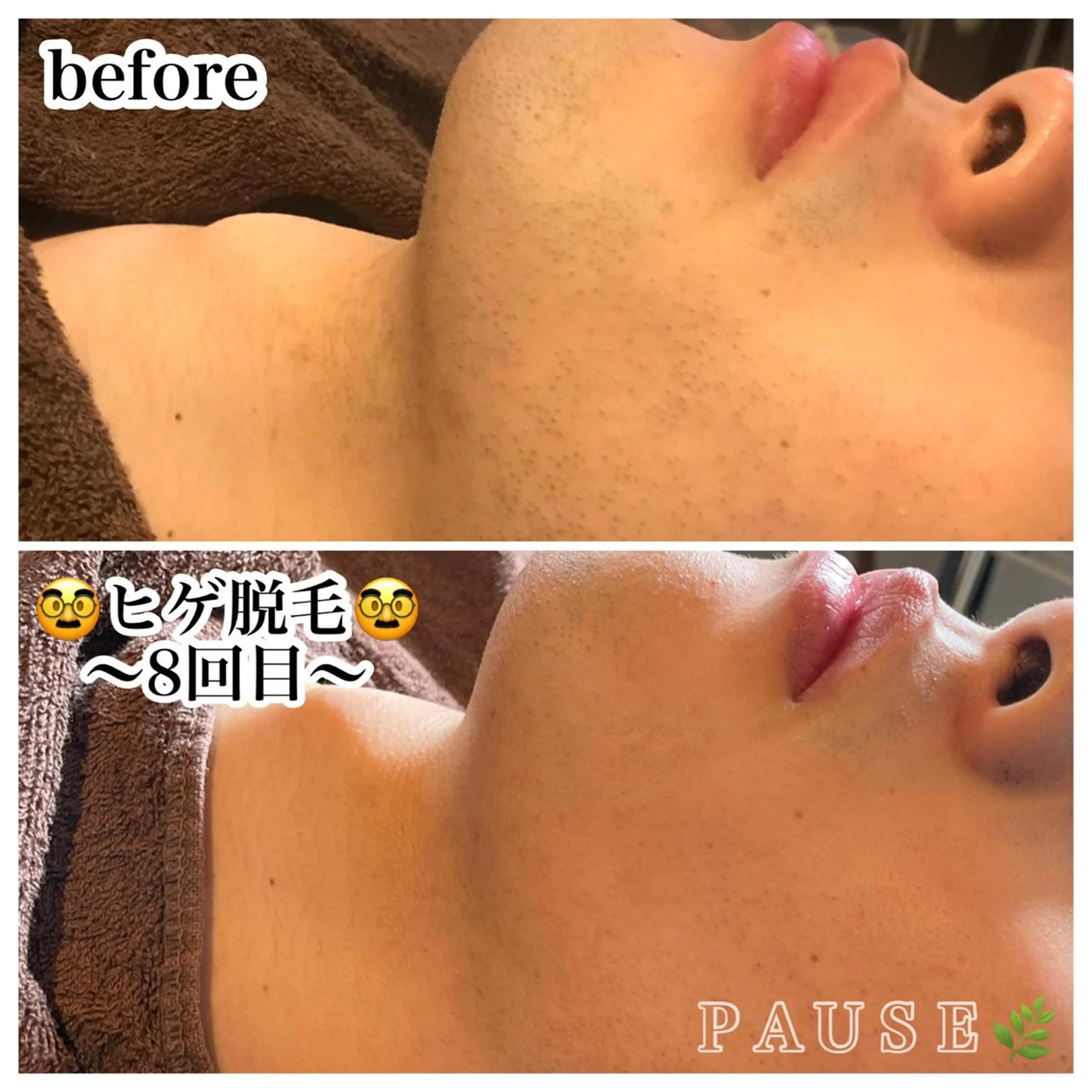 脱毛 浜野 恵美のエステ・リラクイメージ