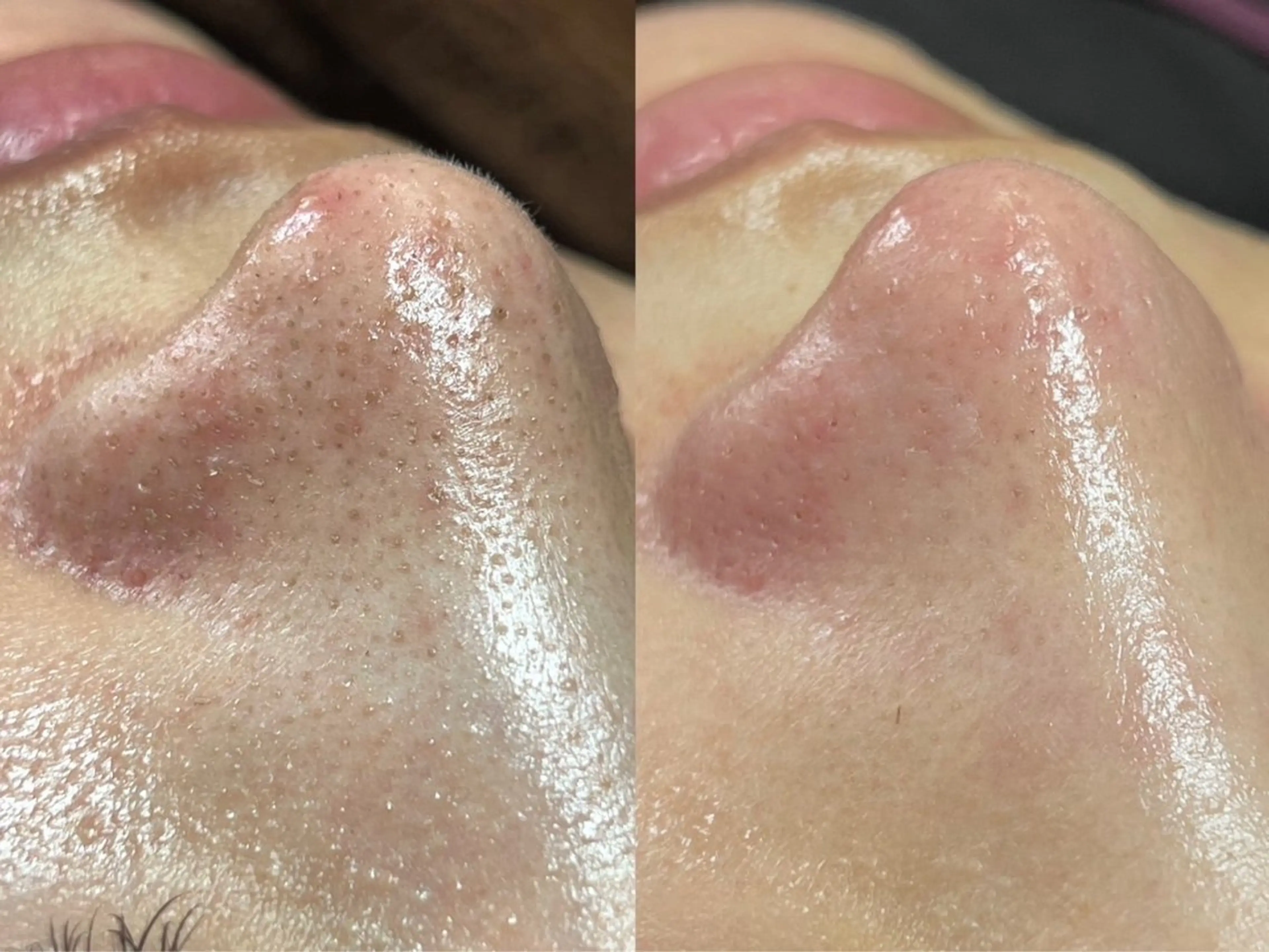 エステ 産後/ツヤ肌/子連れ /保育士在籍サロンのエステ・リラクイメージ