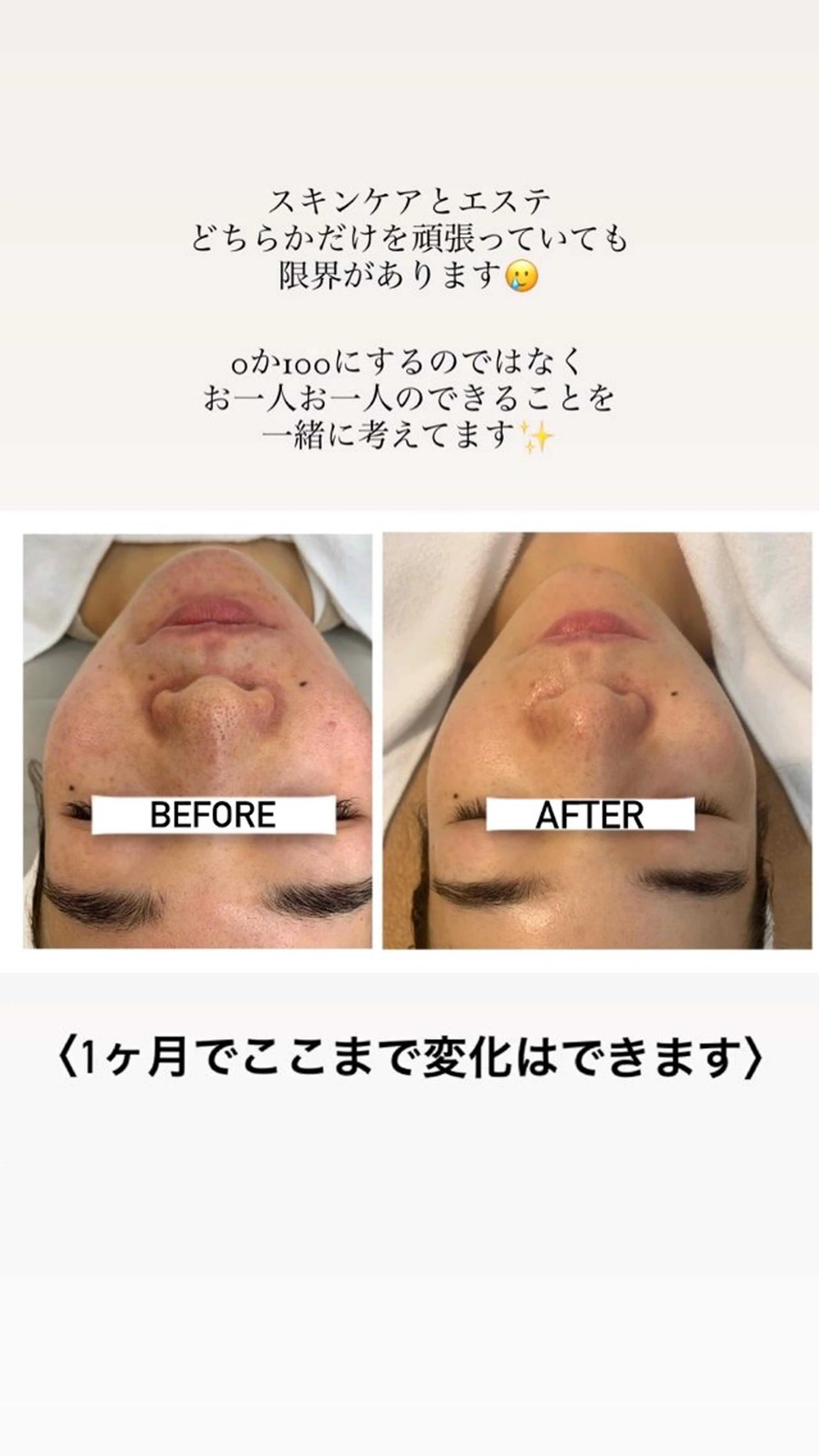 エステ リラク ナリスビューティサロンあべの所属・肌質改善/ツヤ肌作り /松本杏奈のエステ・リラクイメージ