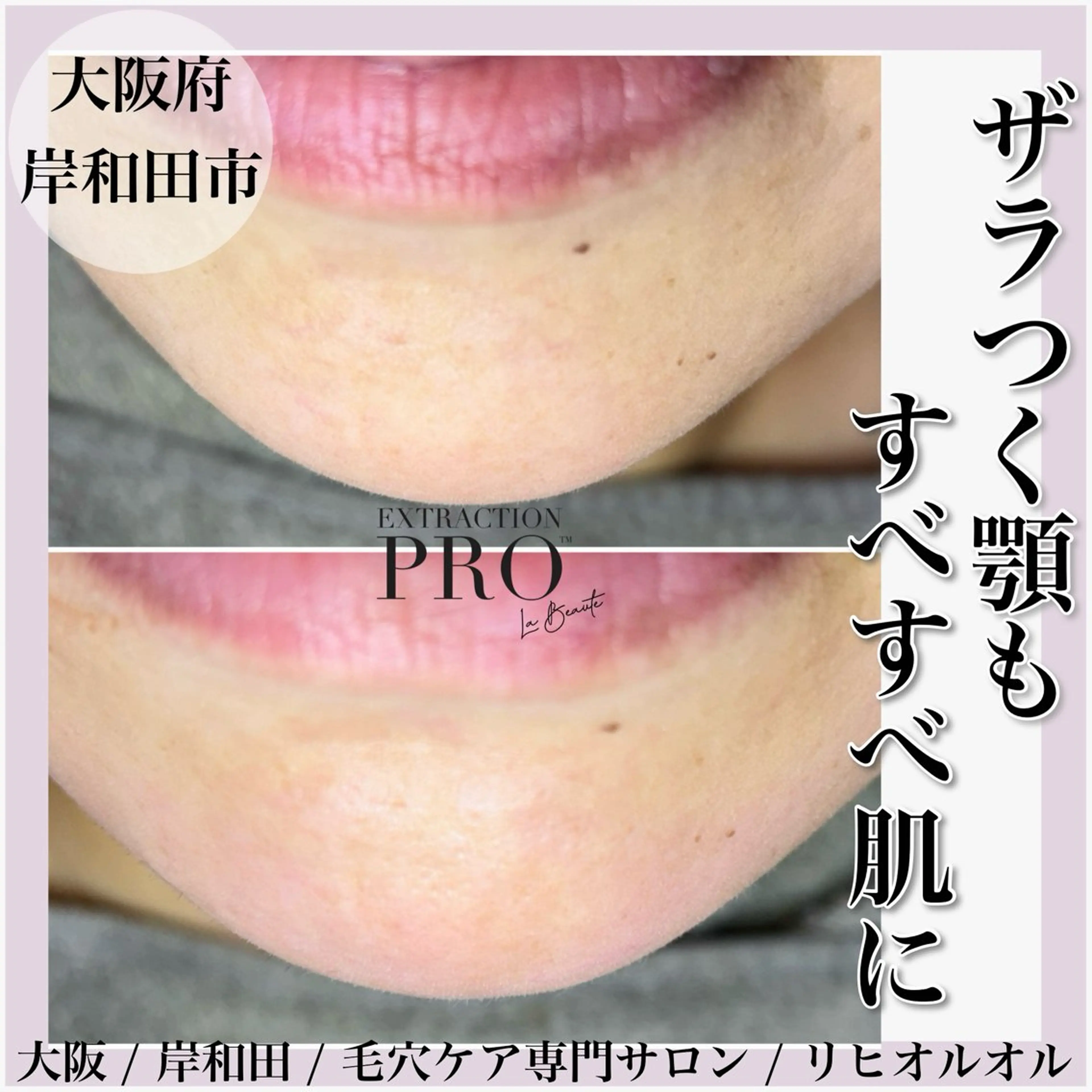 毛穴汚れ改善専門店/ 岸和田/リヒオルオルのエステ・リラクイメージ