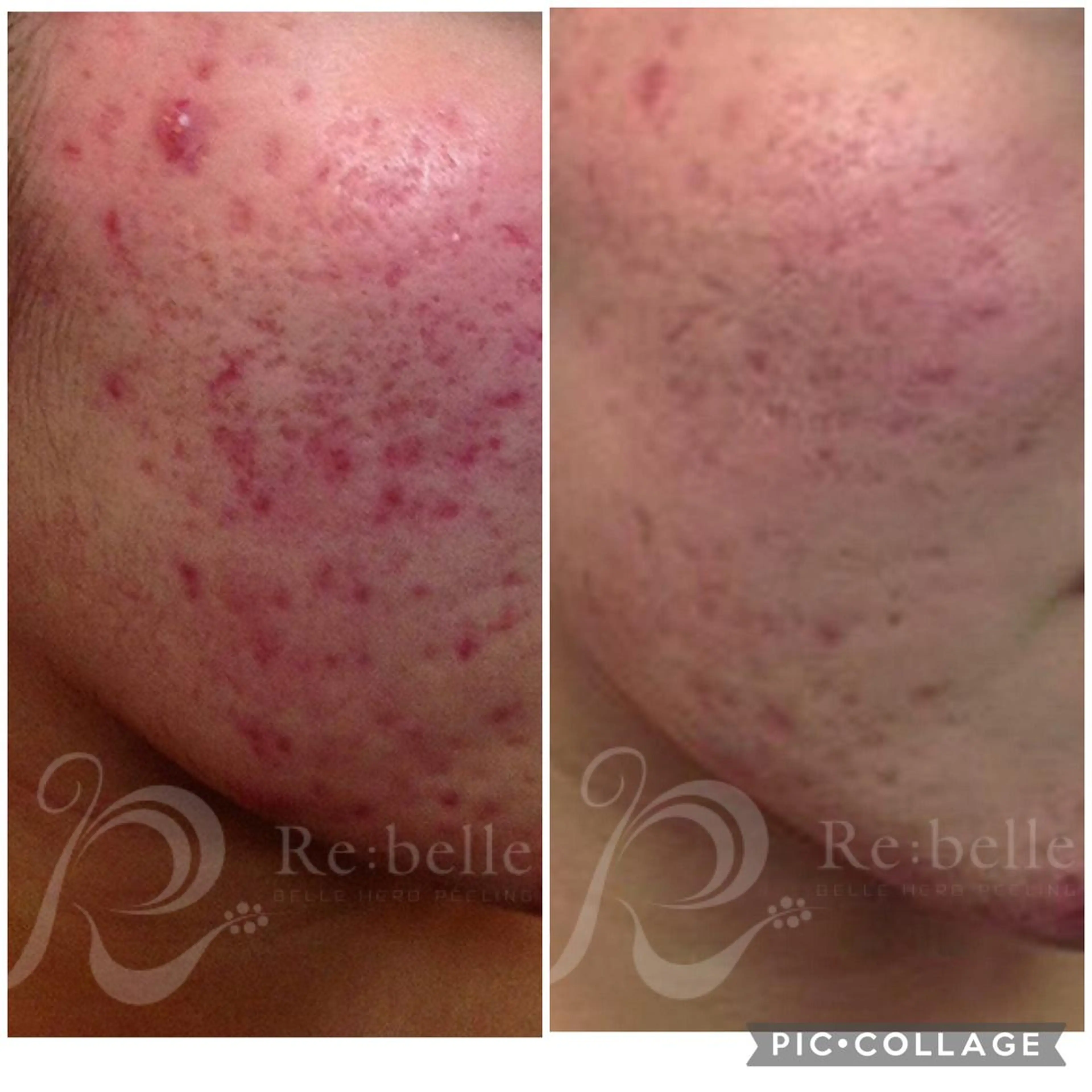 エステ Lavi&所属・肌質改善サロン Ｌａｖｉ＆のその他イメージ