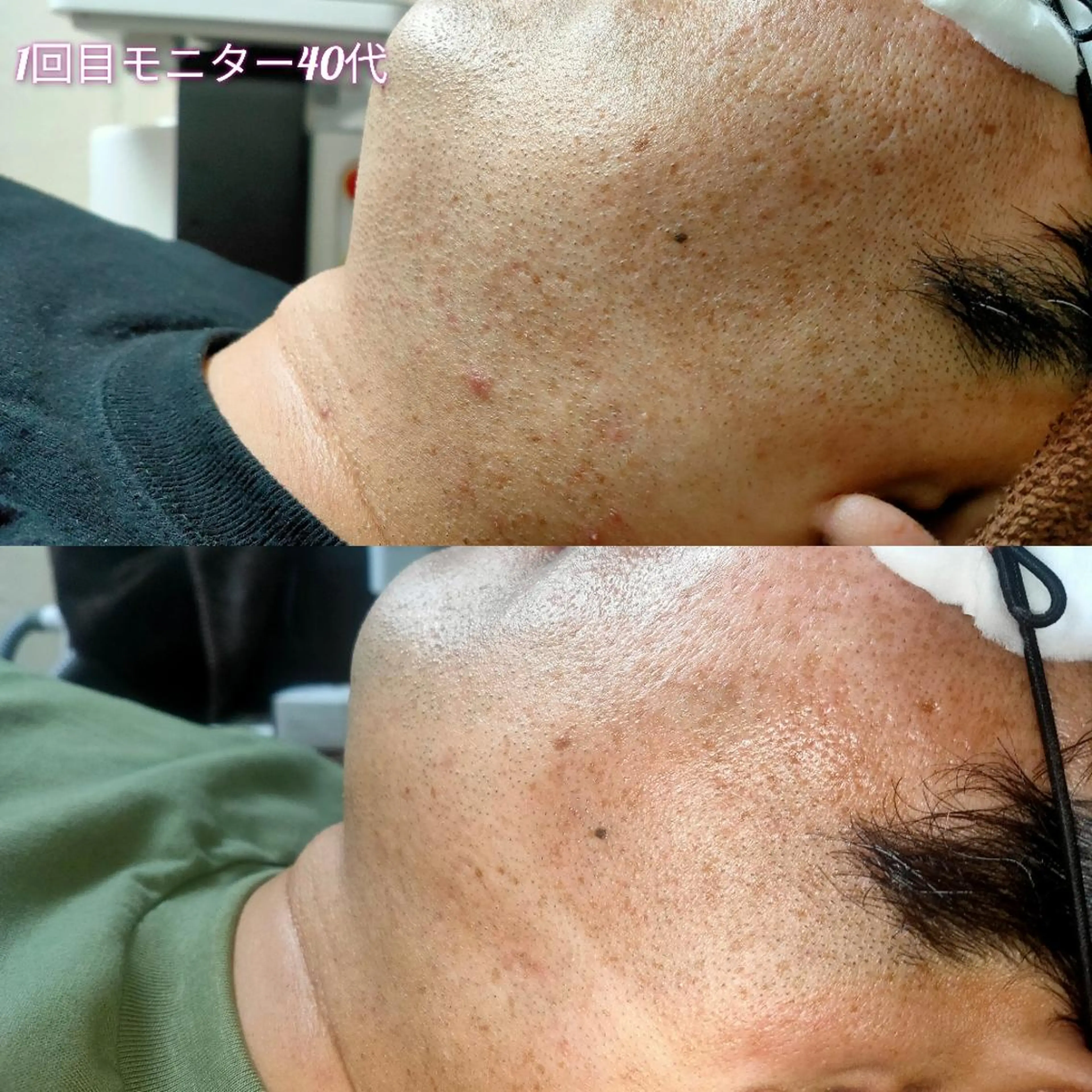 メンズ 脱毛 武 藤のエステ・リラクイメージ