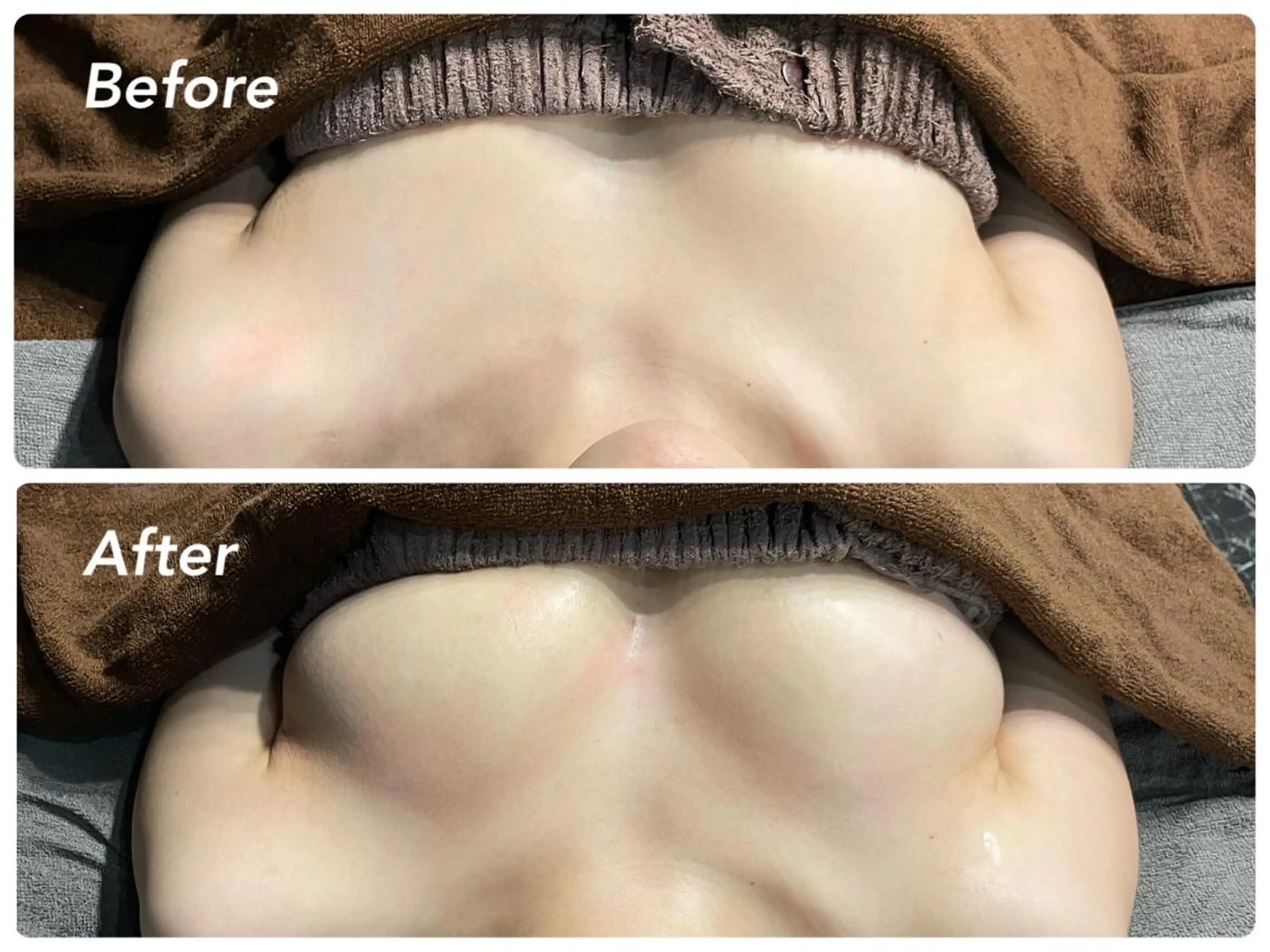 エステ Salon de CocoFranのその他イメージ