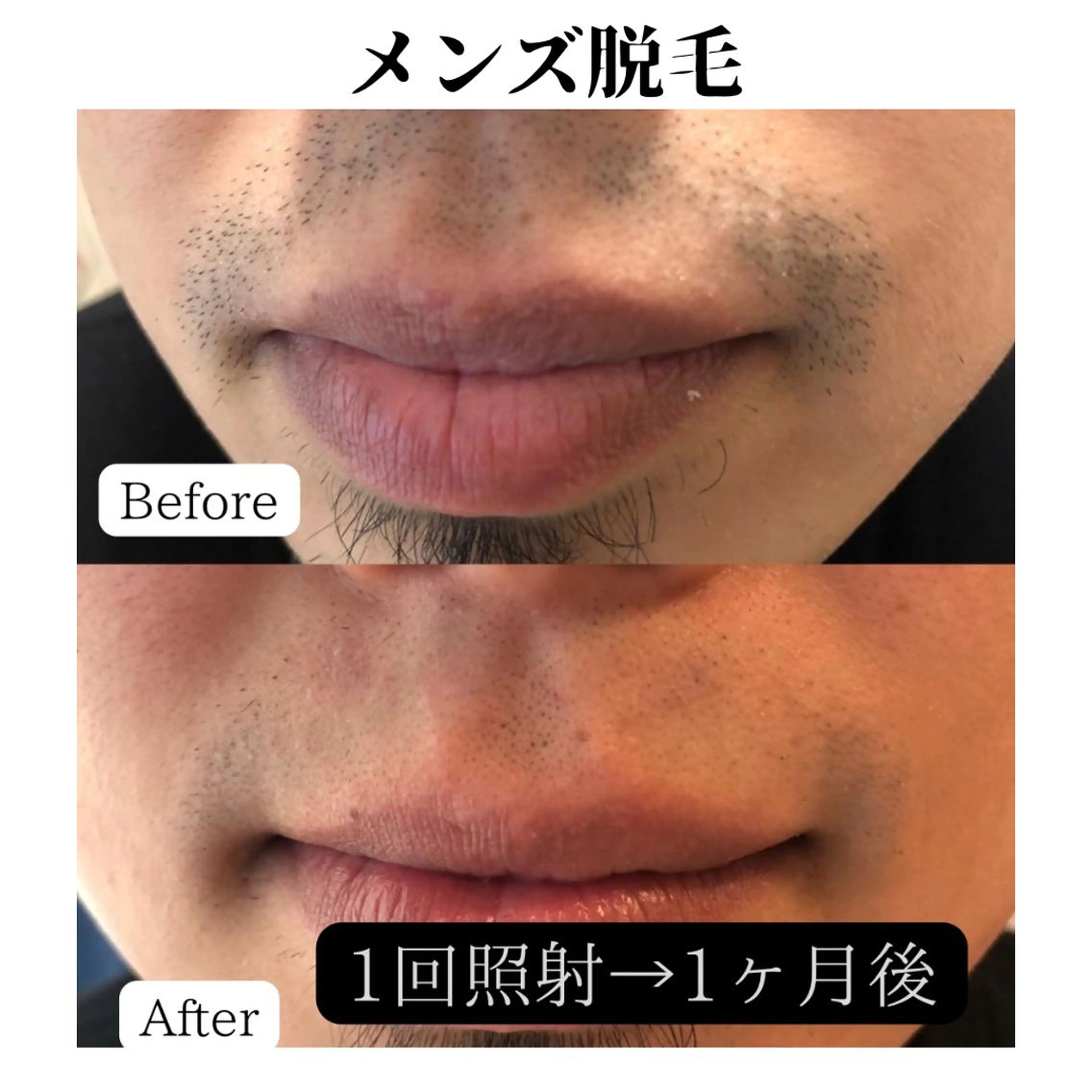 トータルビューティー サロンSalaのマツエク・マツパデザイン