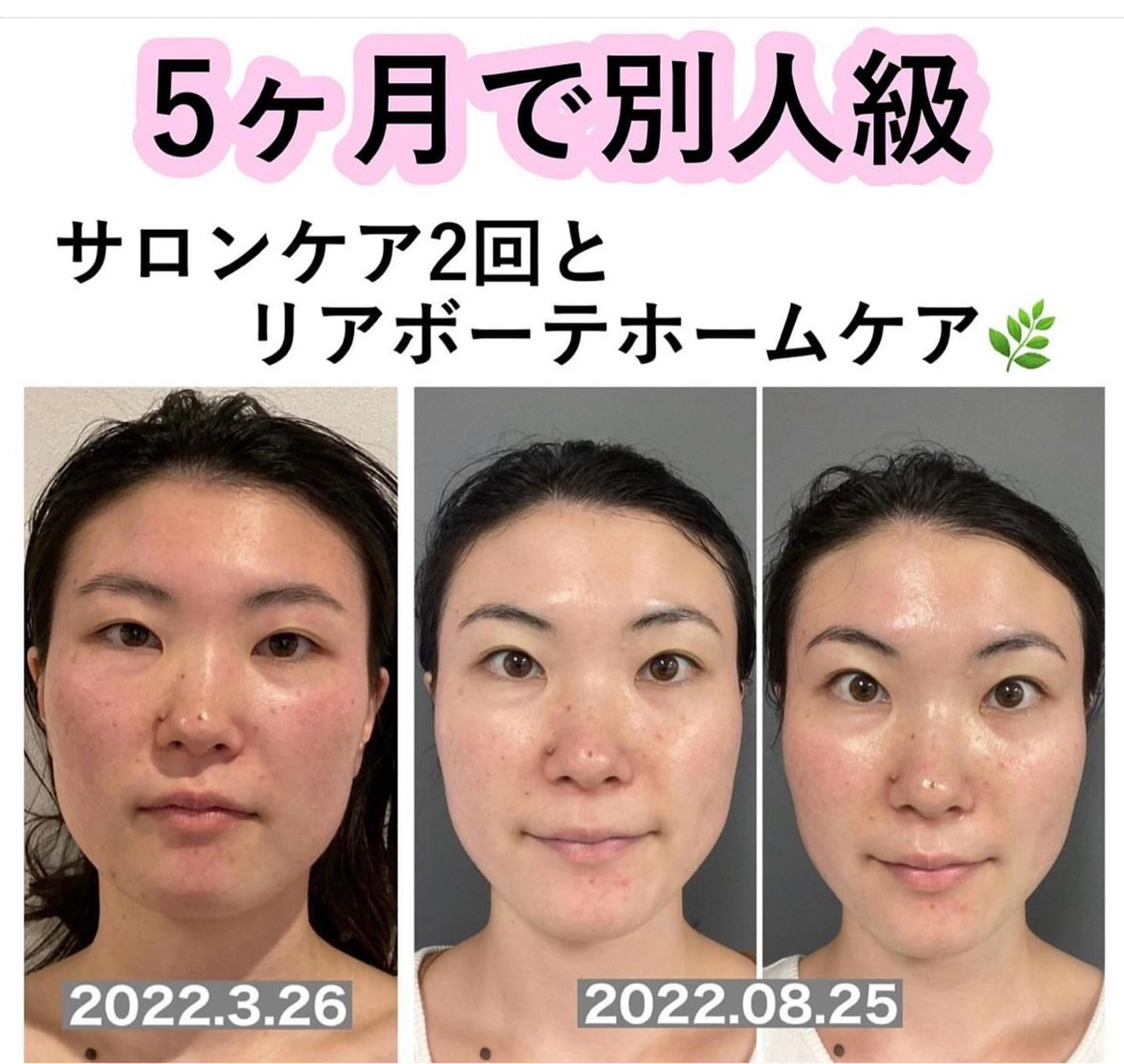 salondeBe 🩵フェイシャル専門のエステ・リラクイメージ