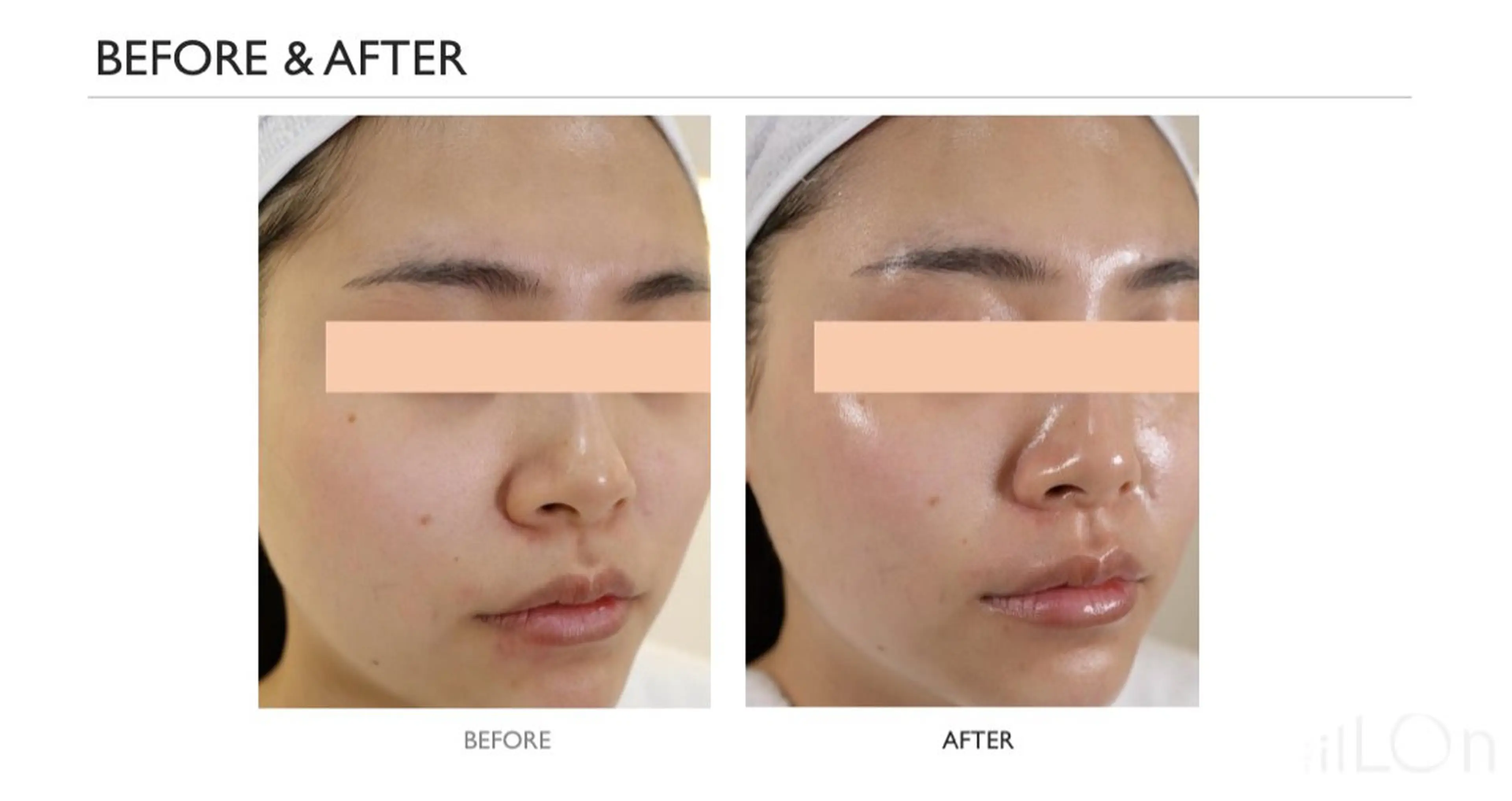 Myuraオーナー MIYUのエステ・リラクイメージ