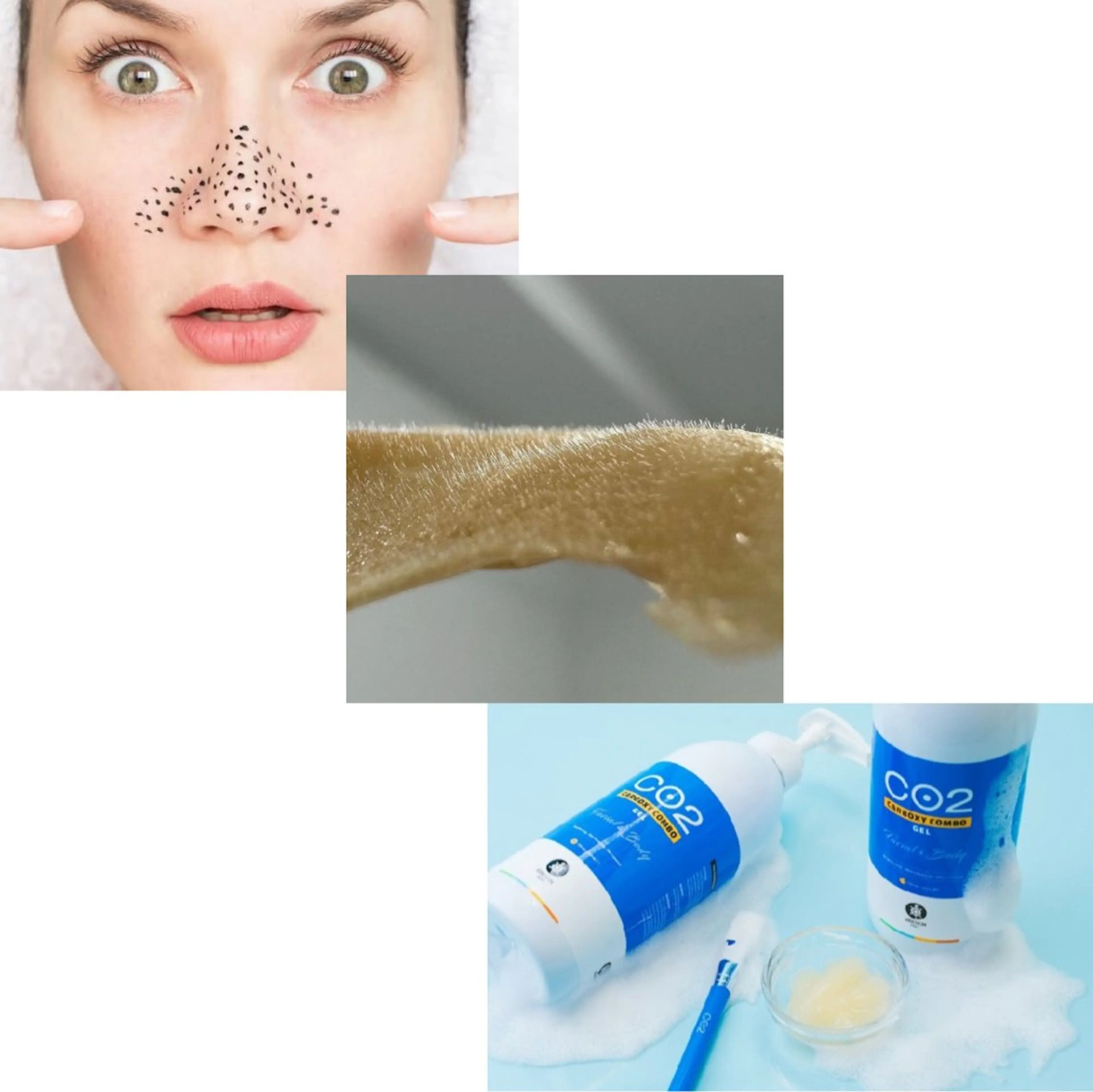 【見て触ってその場で実感！】鼻毛穴洗浄+鼻WAX+肌質改善高濃度炭酸トリートメントの写真