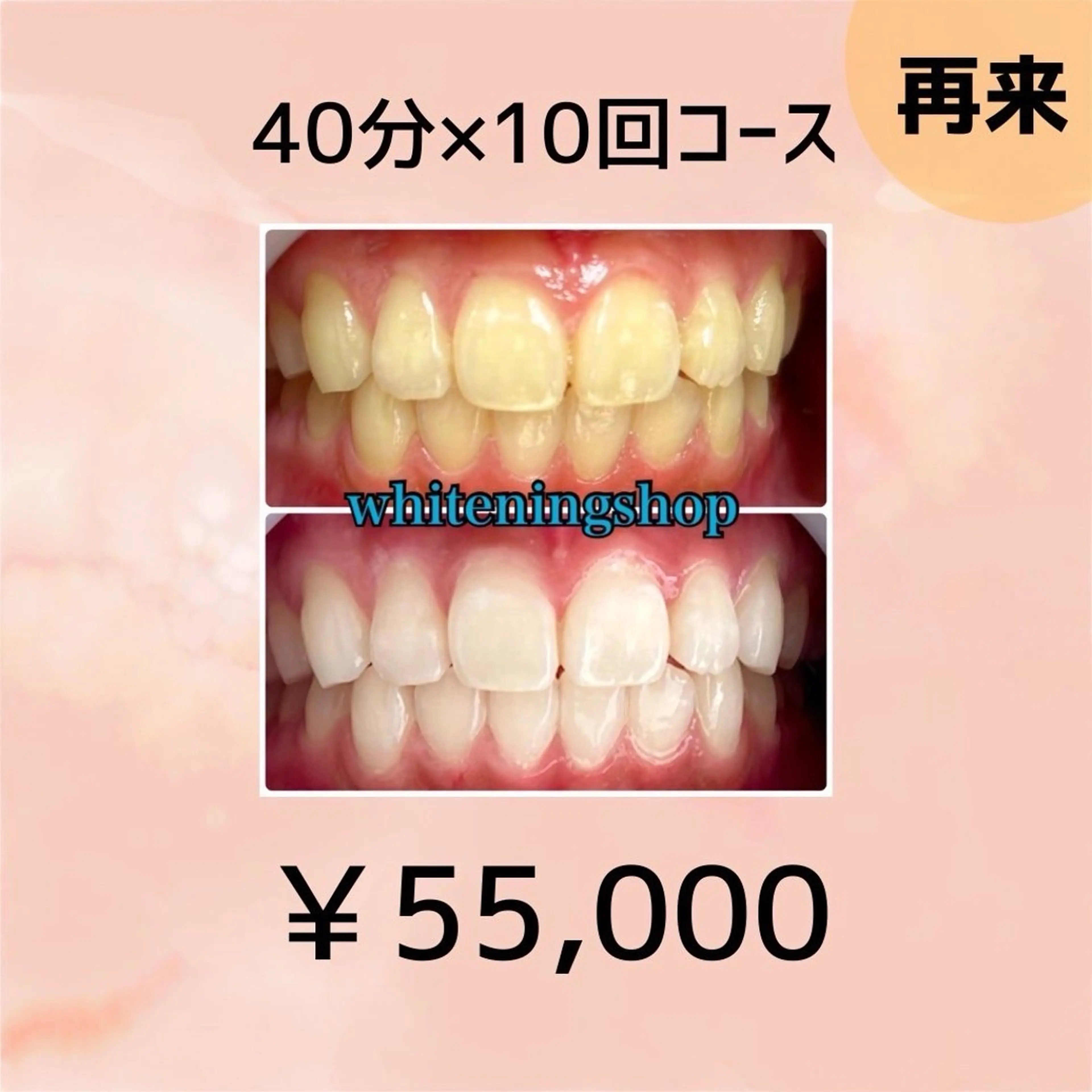 【2回目以降ご来店の方も回数券ご購入可能です🥰】40分×10回照射✨の写真