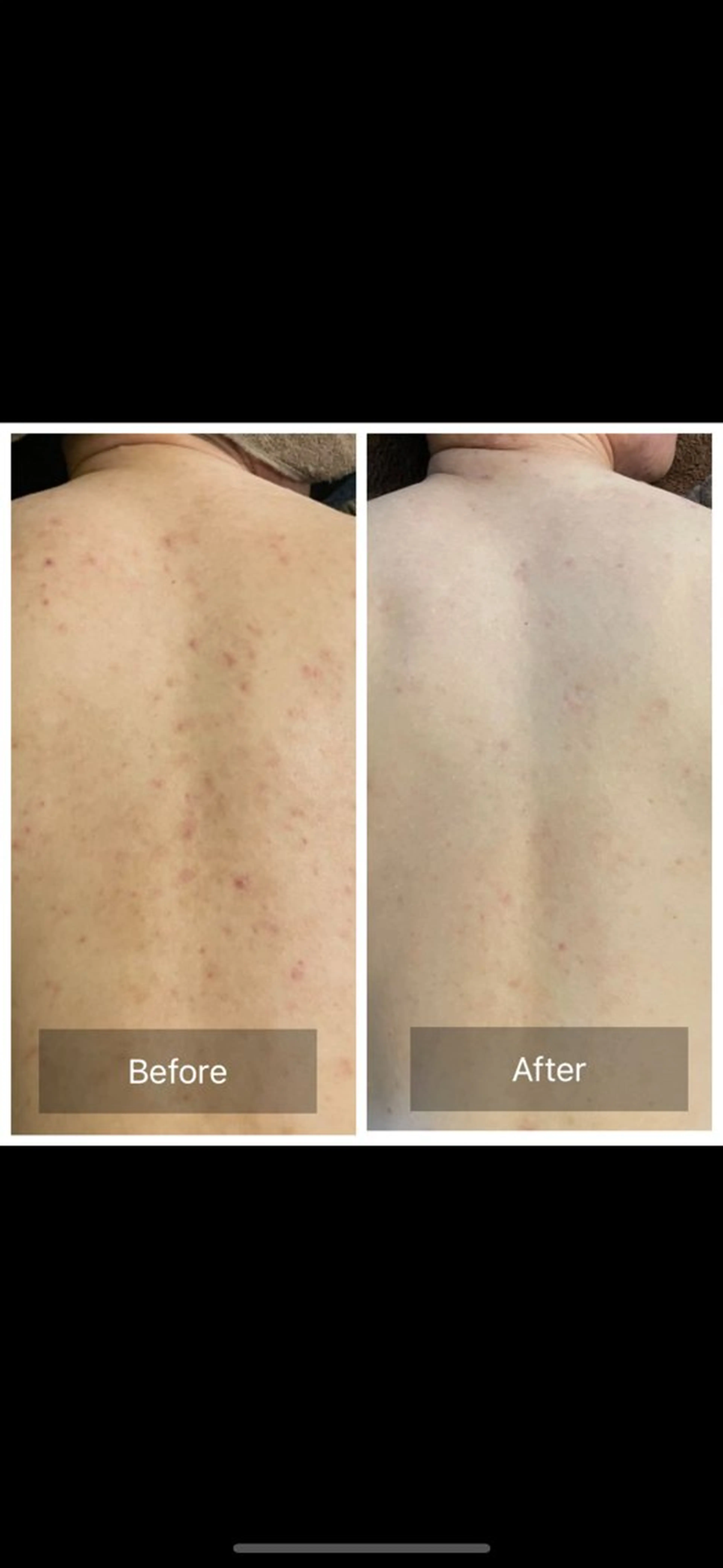 痩身・リンパ専門 Lilas広島駅前店のその他イメージ