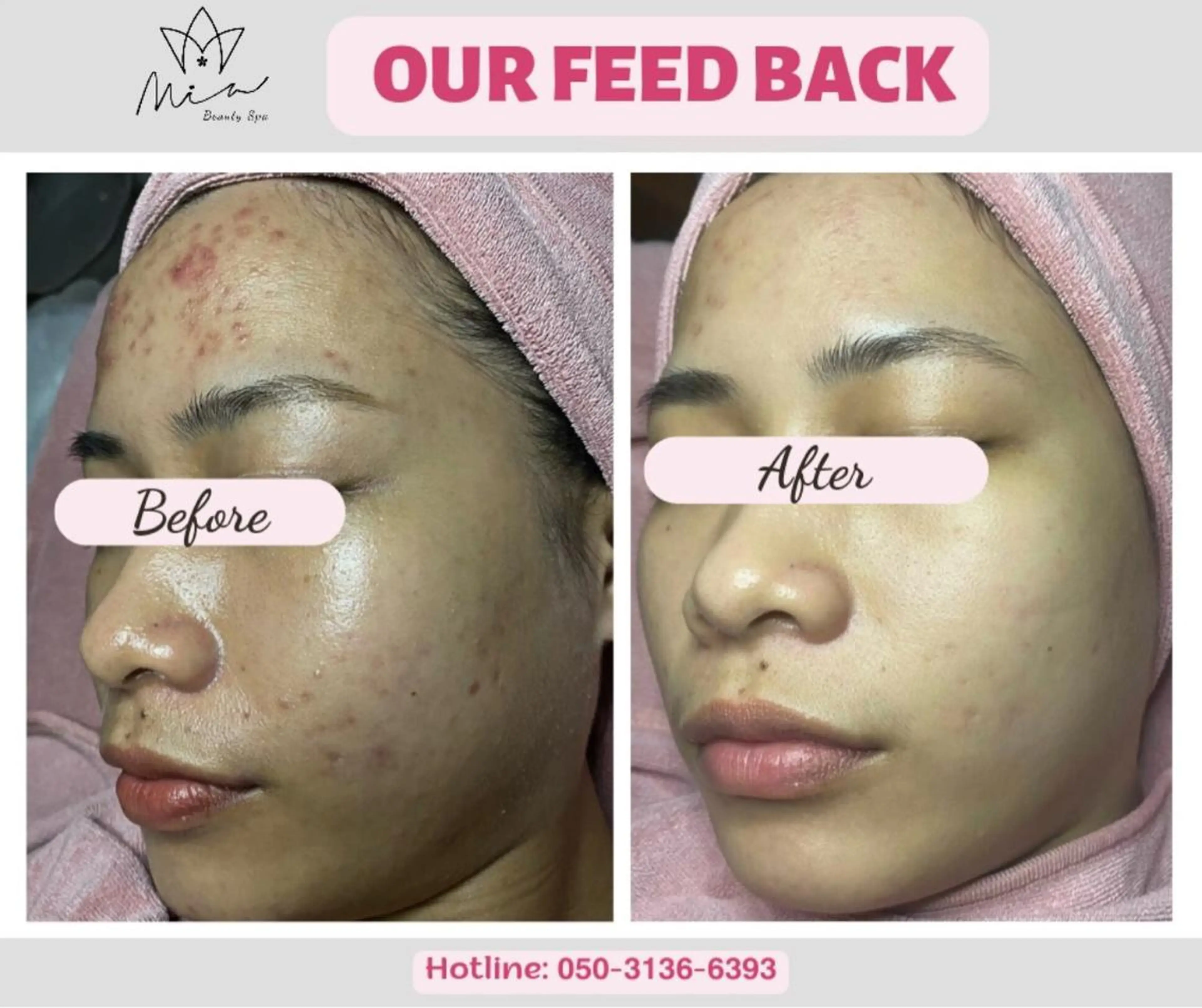 エステ MiA Beautyのエステ・リラクイメージ