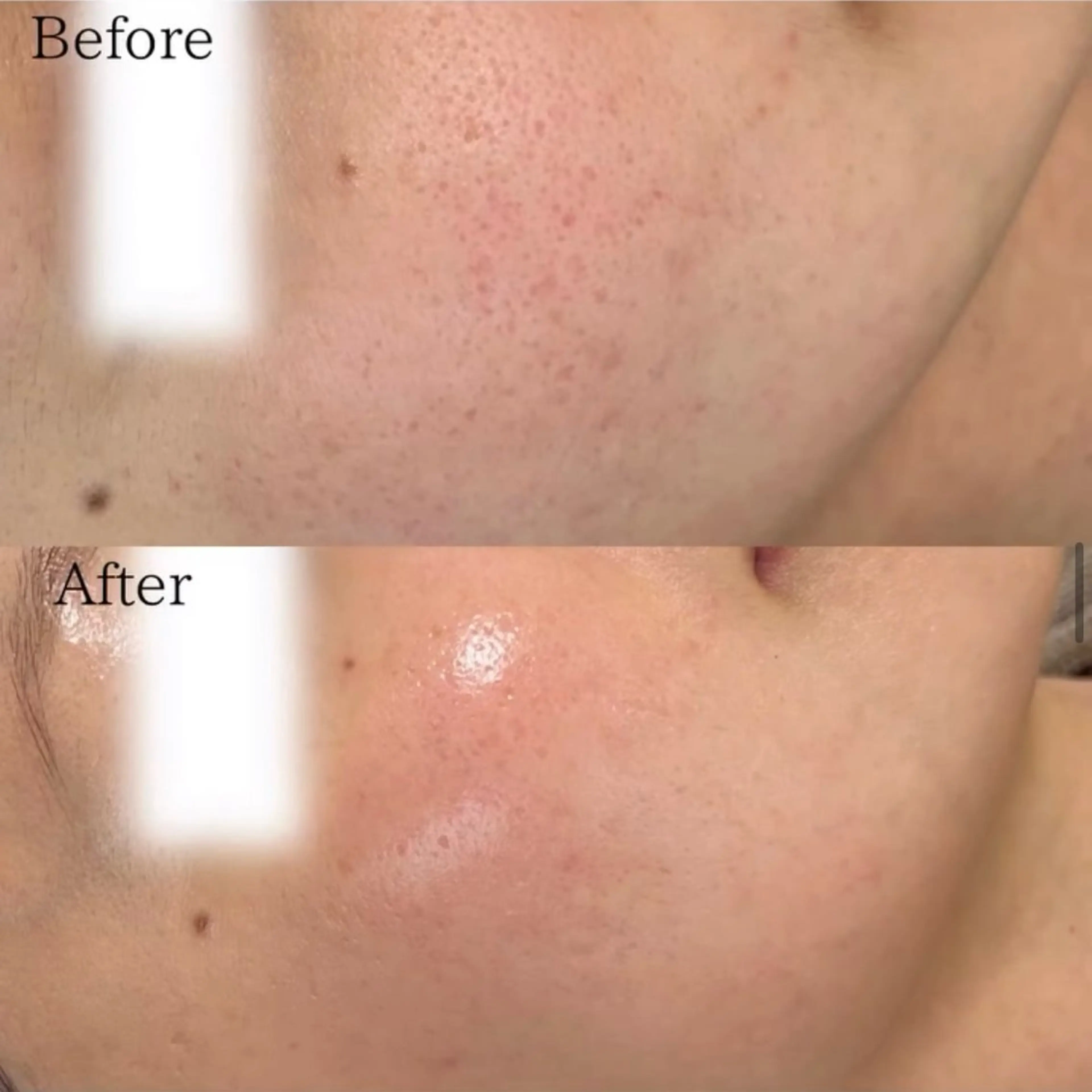 silo 結果重視の美肌サロンのエステ・リラクイメージ