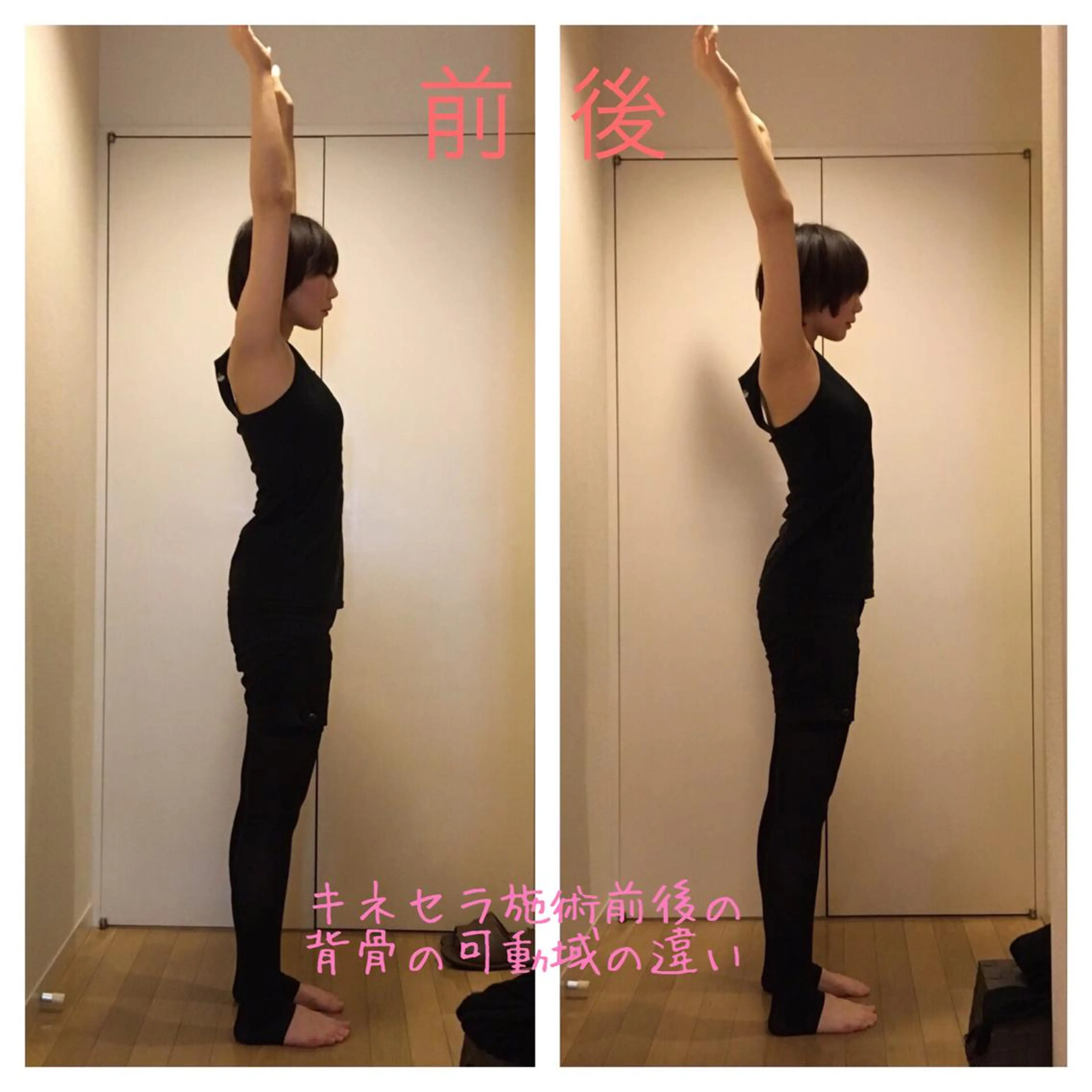 【肩こり、腰痛】キネスティックセラピー 【背骨調律】  女性の写真