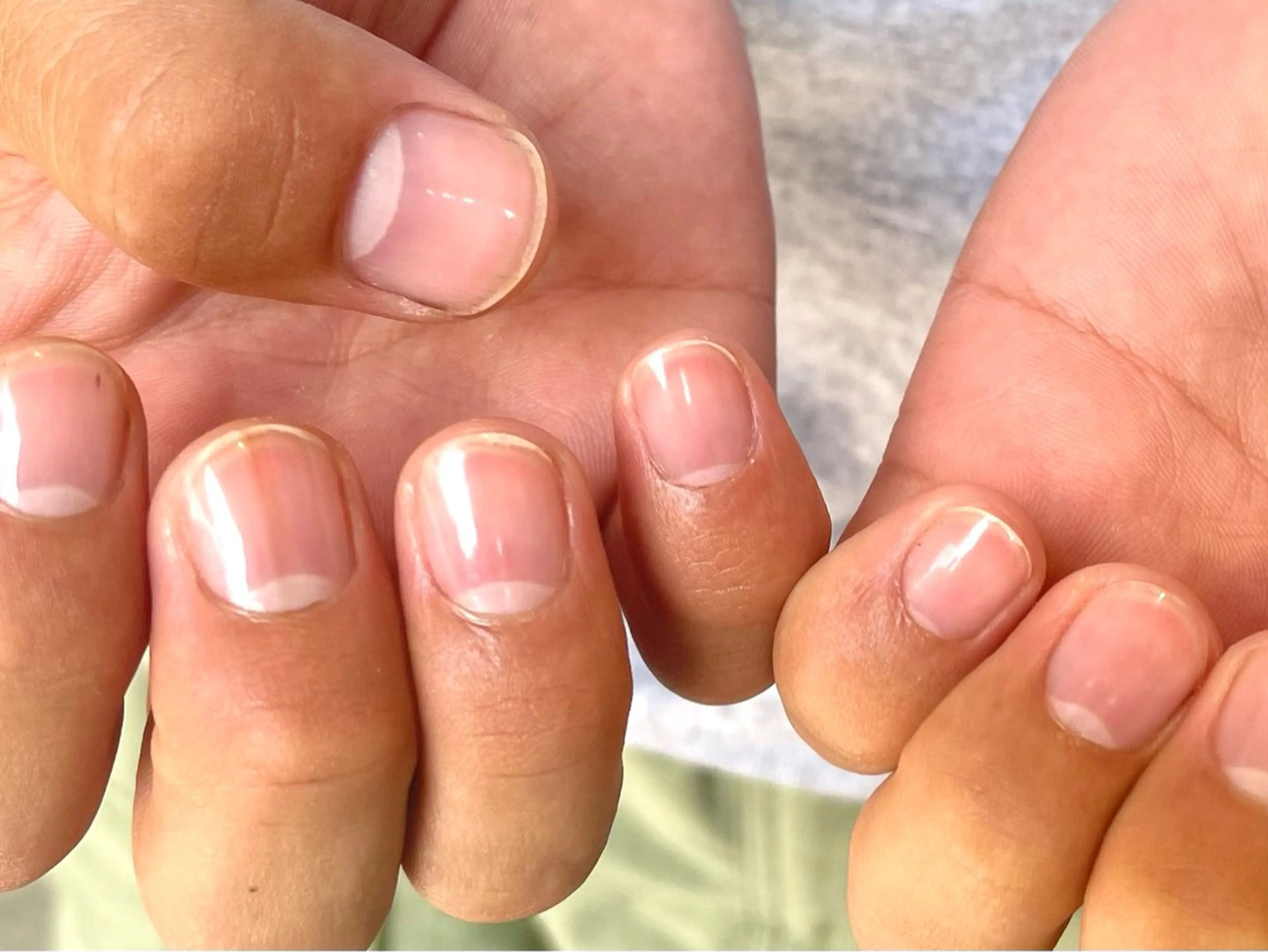 【ミニモ限定】ハンドケア×乾燥対策パック✨の写真