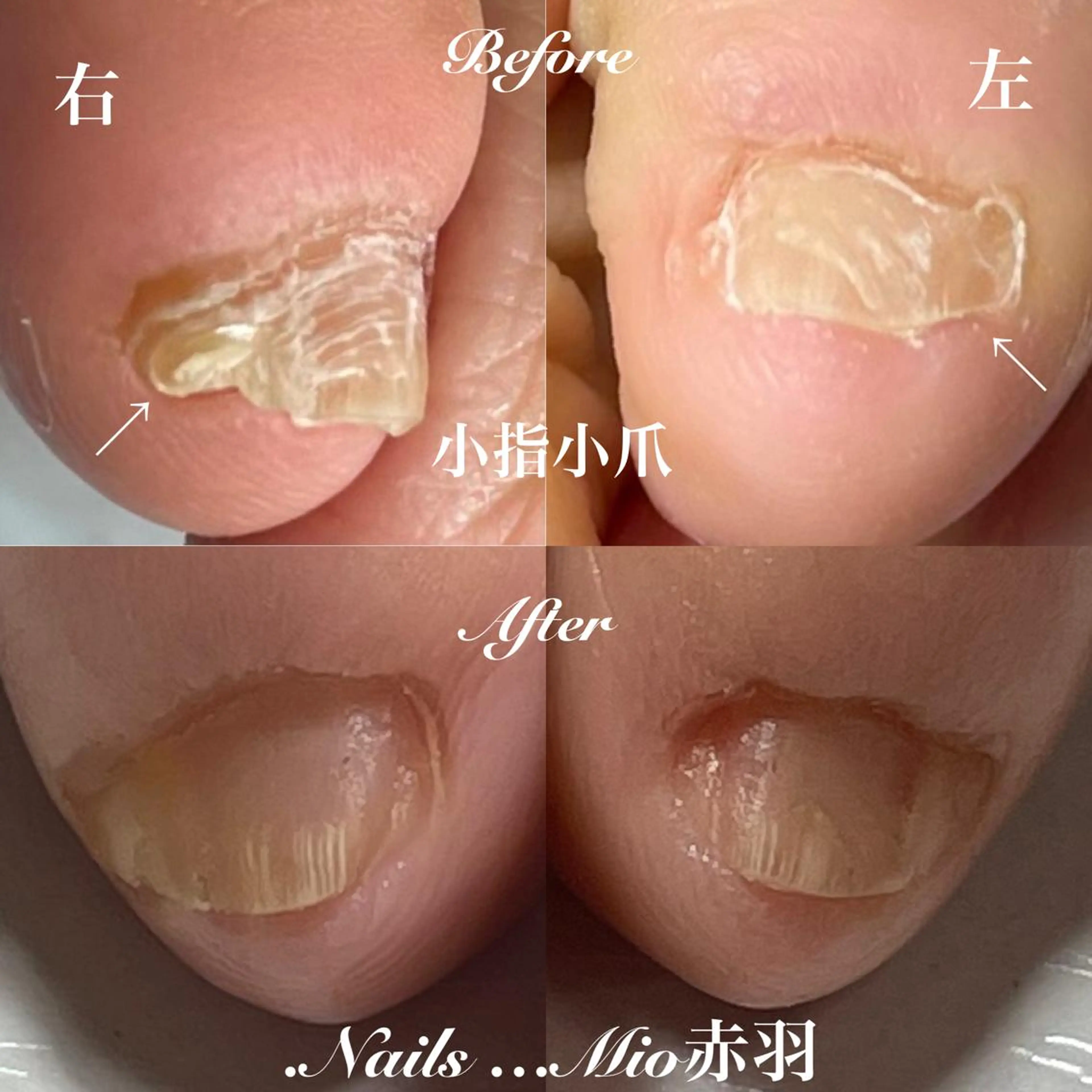 ネイル フットネイル .Nails Mio 赤羽西ネイルサロンのネイルデザイン