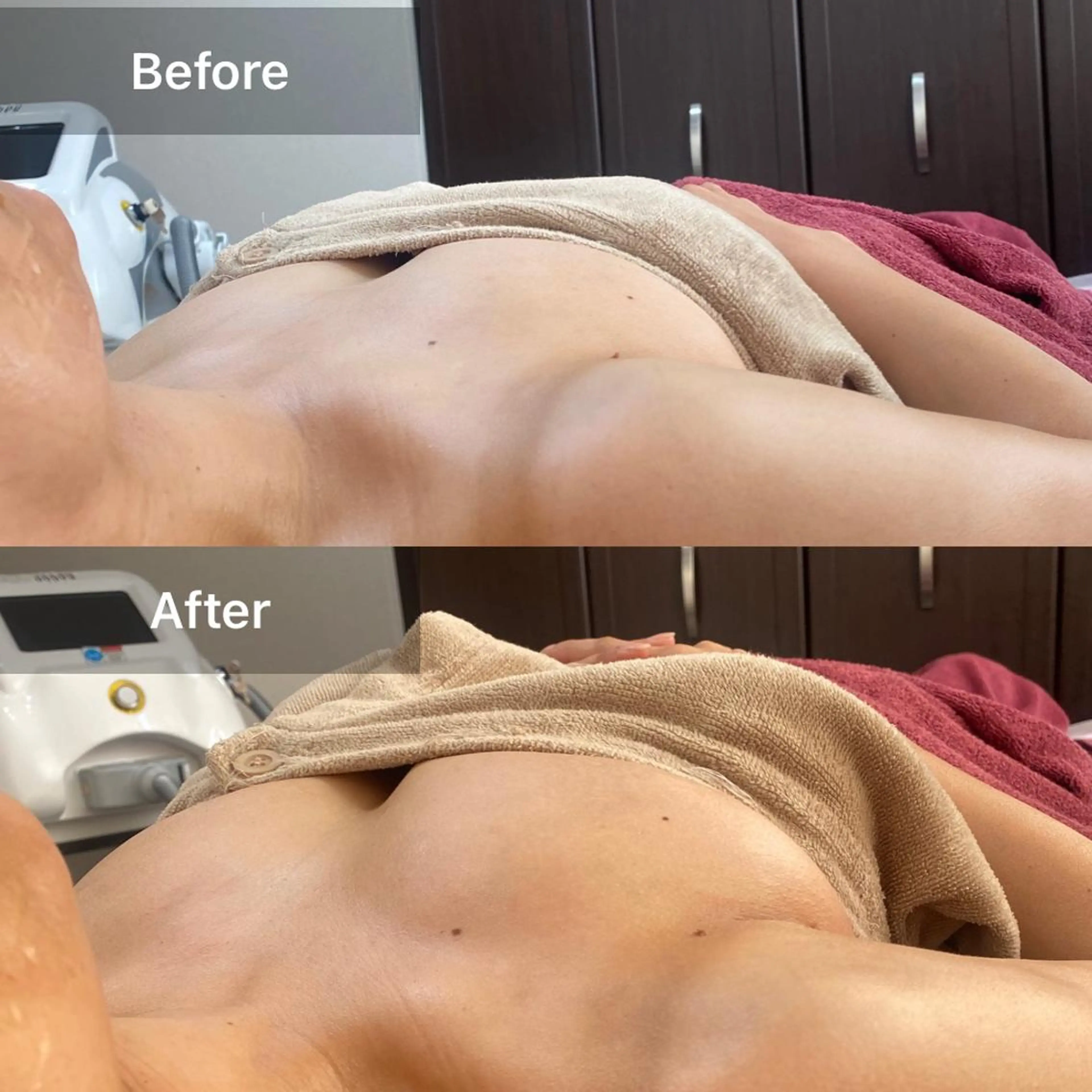 MARIRE EPISALONのエステ・リラクイメージ