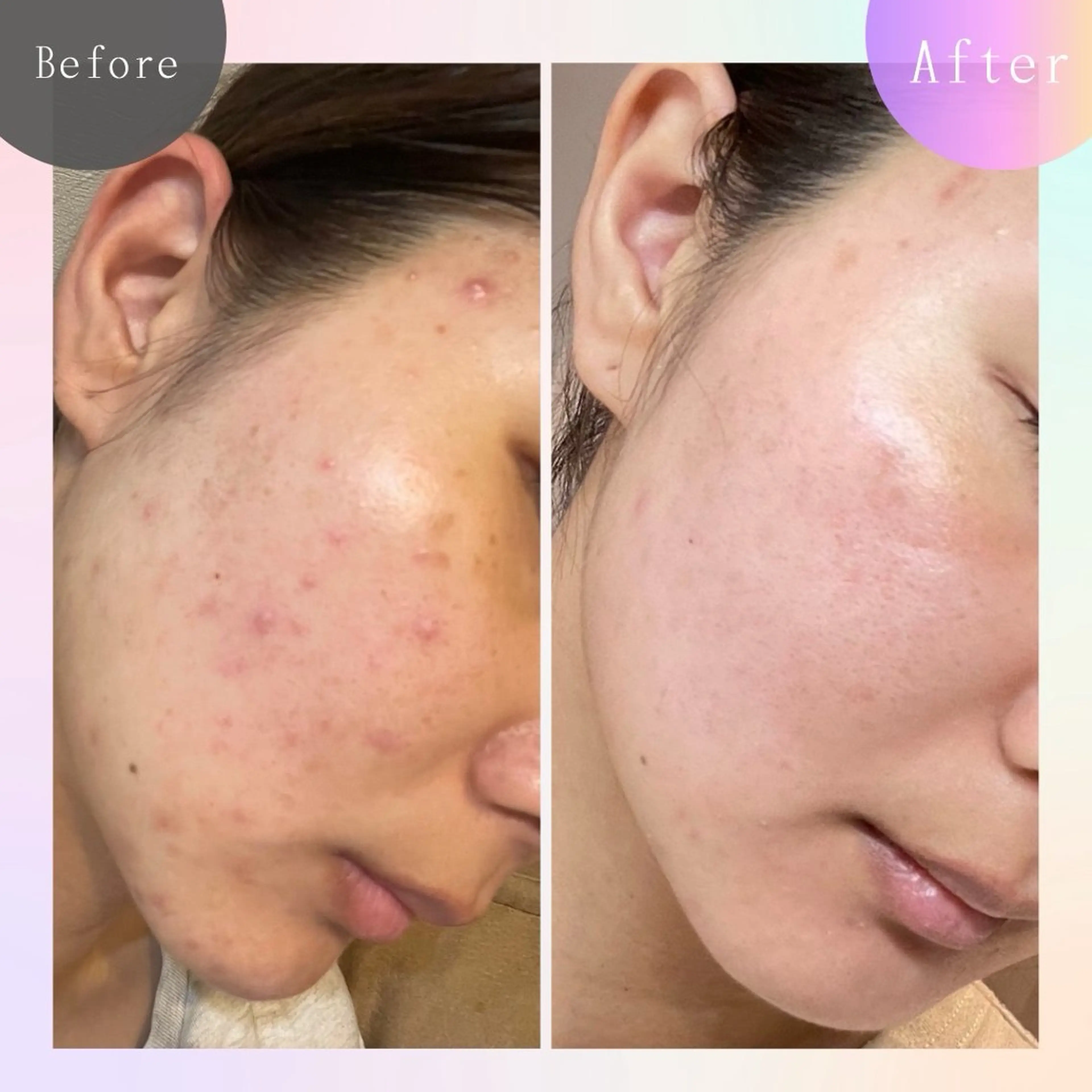 毛穴改善サロン d'Alba大阪住吉のエステ・リラクイメージ