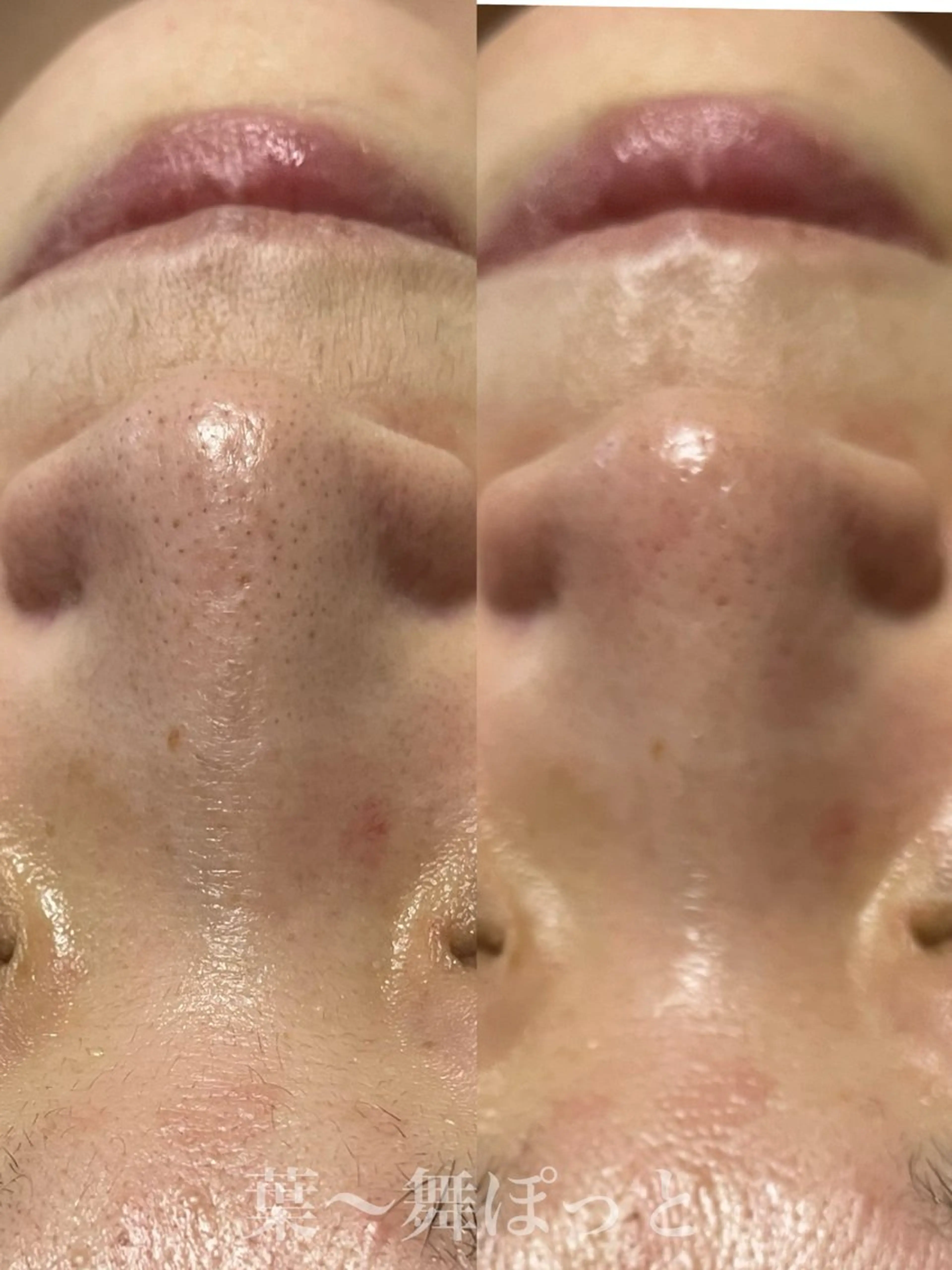 うえつま ふみえのエステ・リラクイメージ