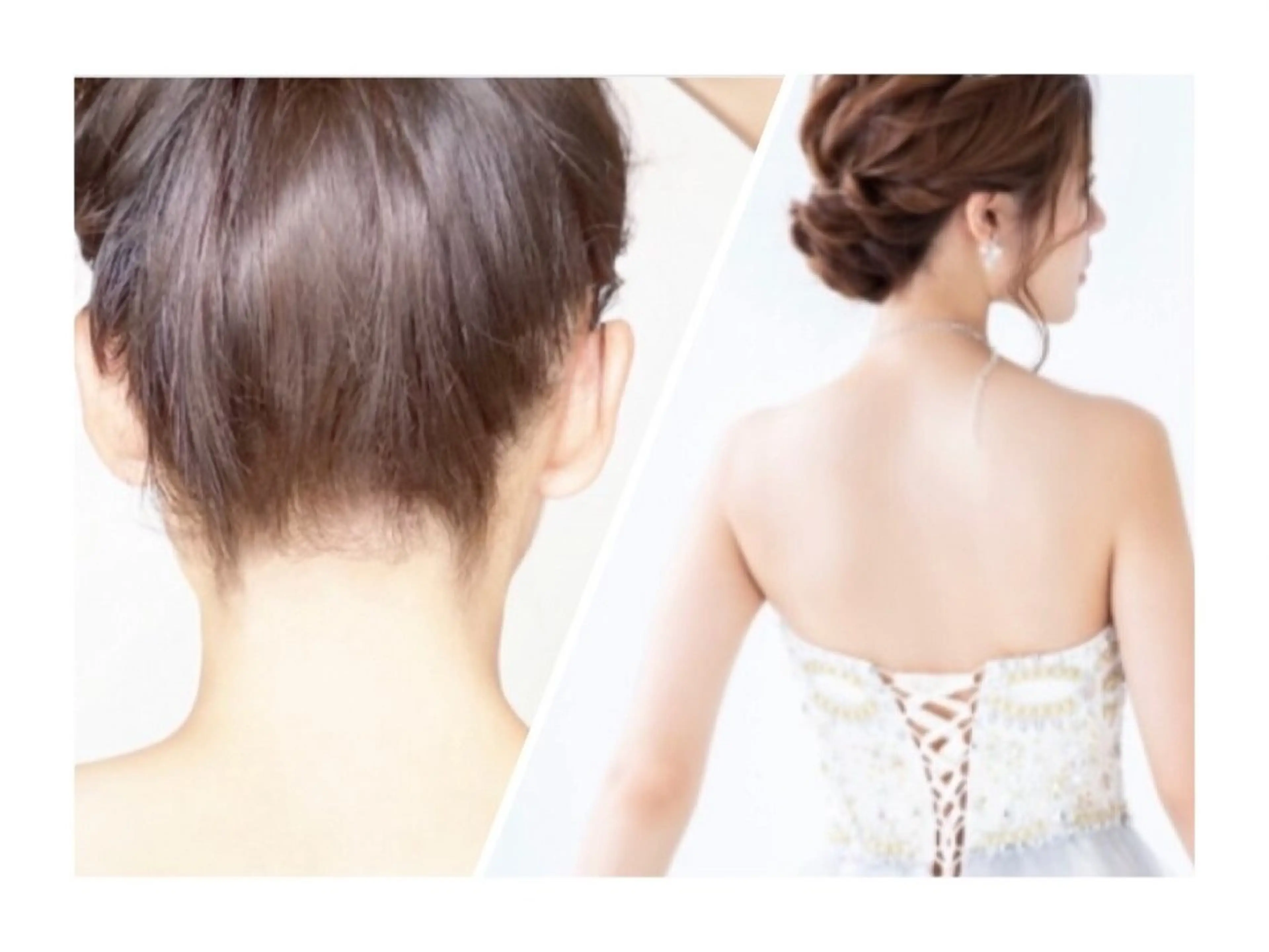 【自分で出来ない所だけケア！】レディース脱毛★うなじ＋背中(シェービング込)の写真