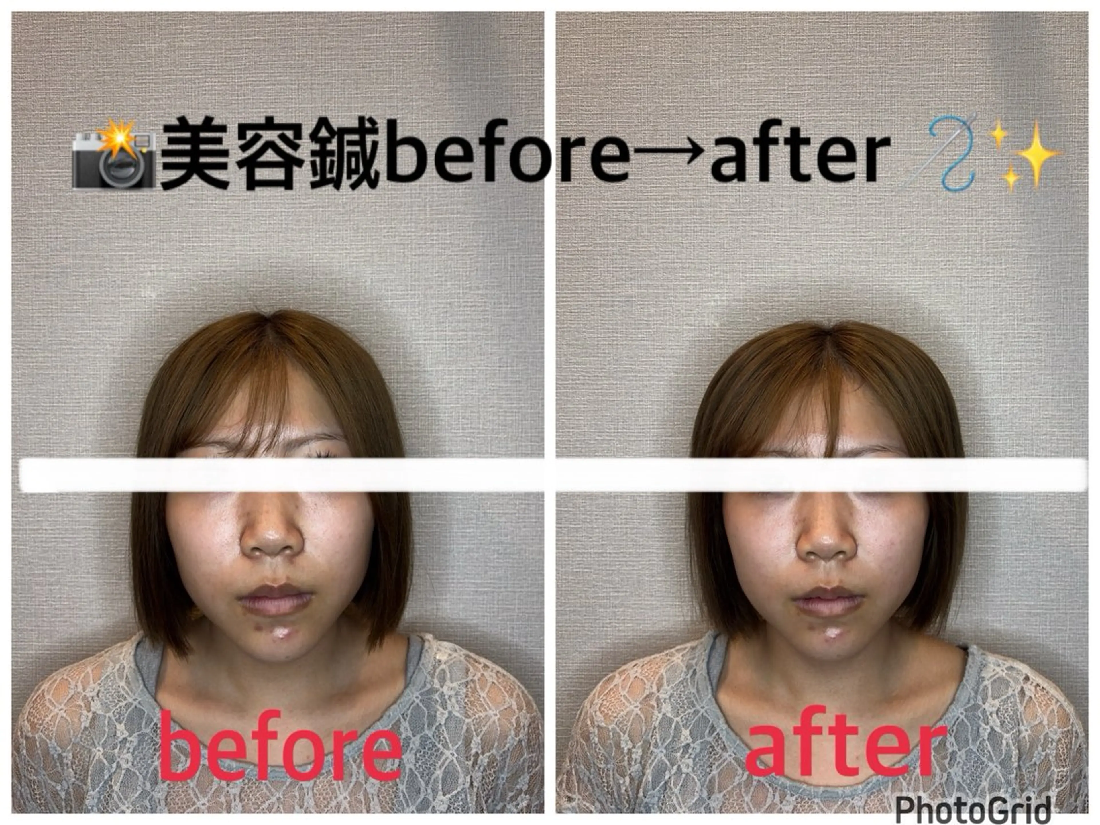 その他 小林整骨院本町 美容鍼roomのエステ・リラクイメージ