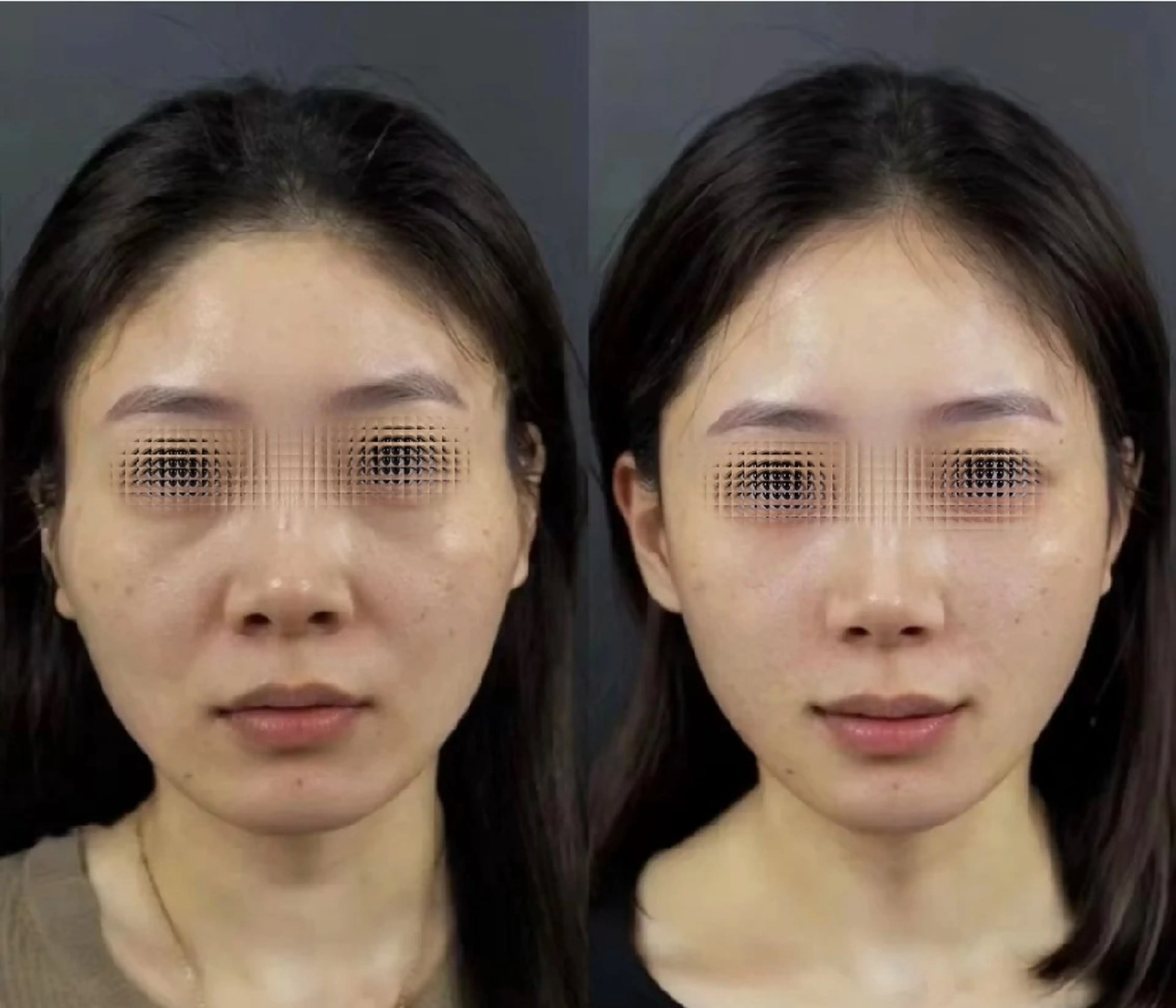 マツエク・マツパ 結婚式・ブライダル aliaハーブ水光店 エステティシャン募集のエステ・リラクイメージ