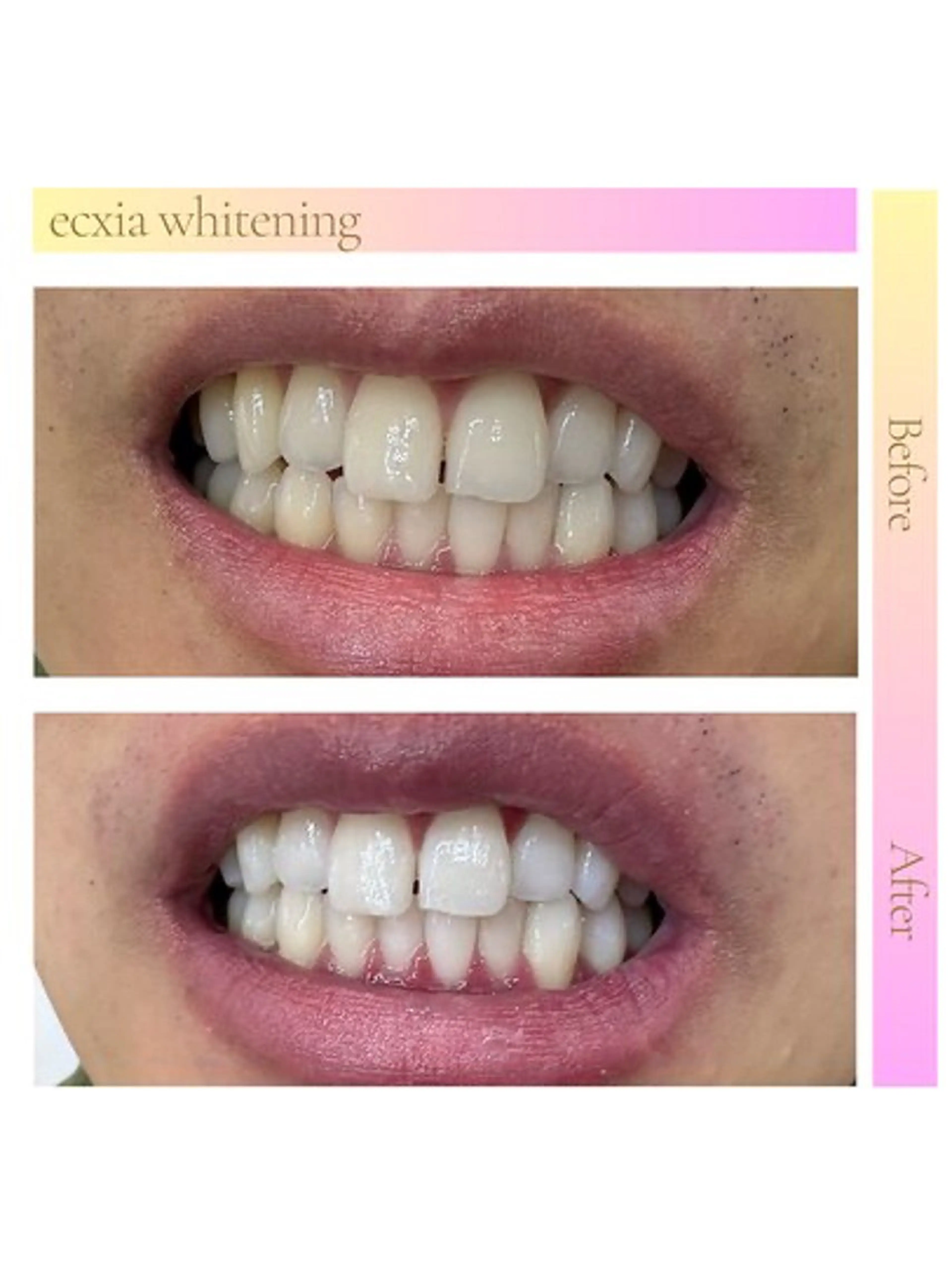 エクシア ホワイトニング西条店のその他イメージ