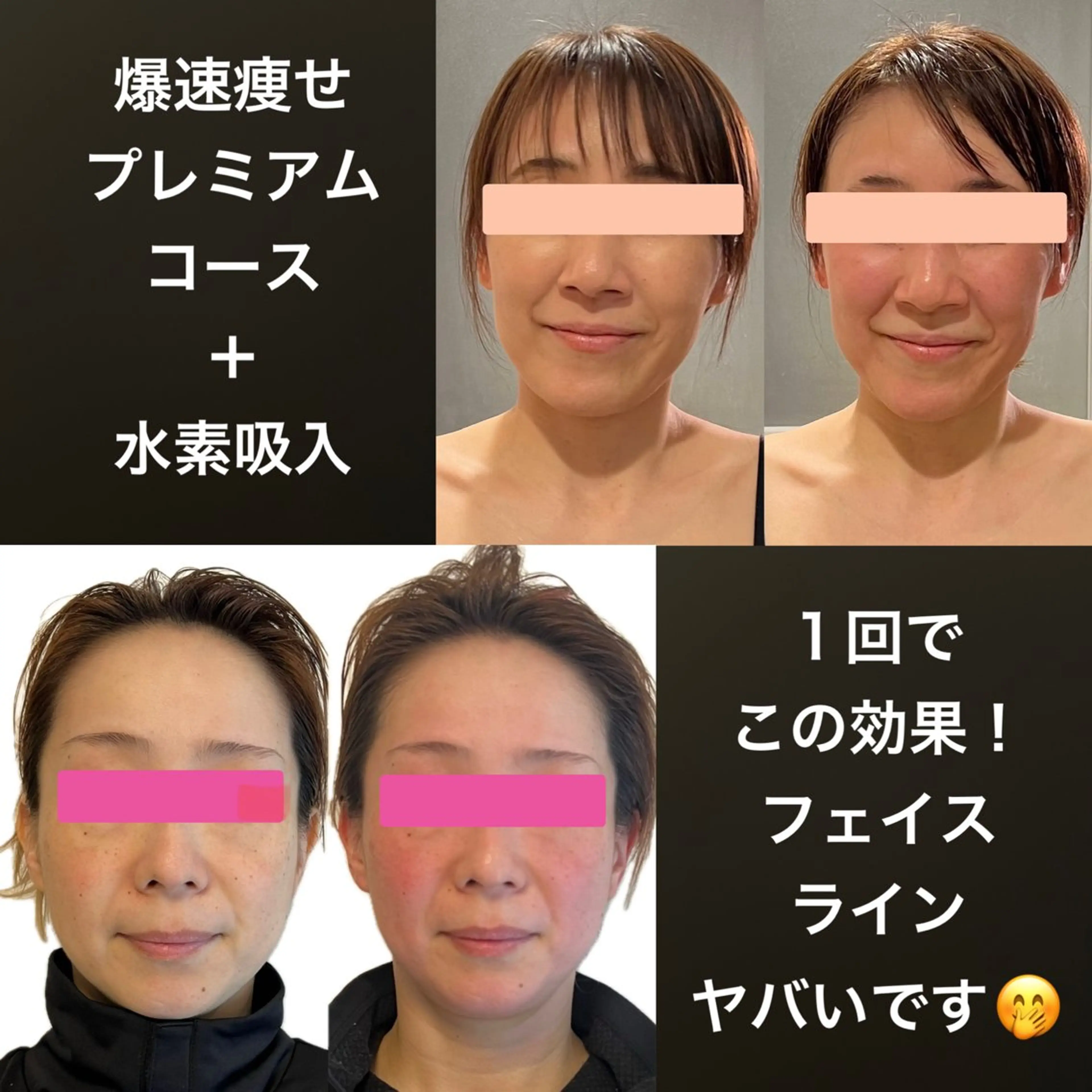 YOSAPARK jela 橋本のエステ・リラクイメージ