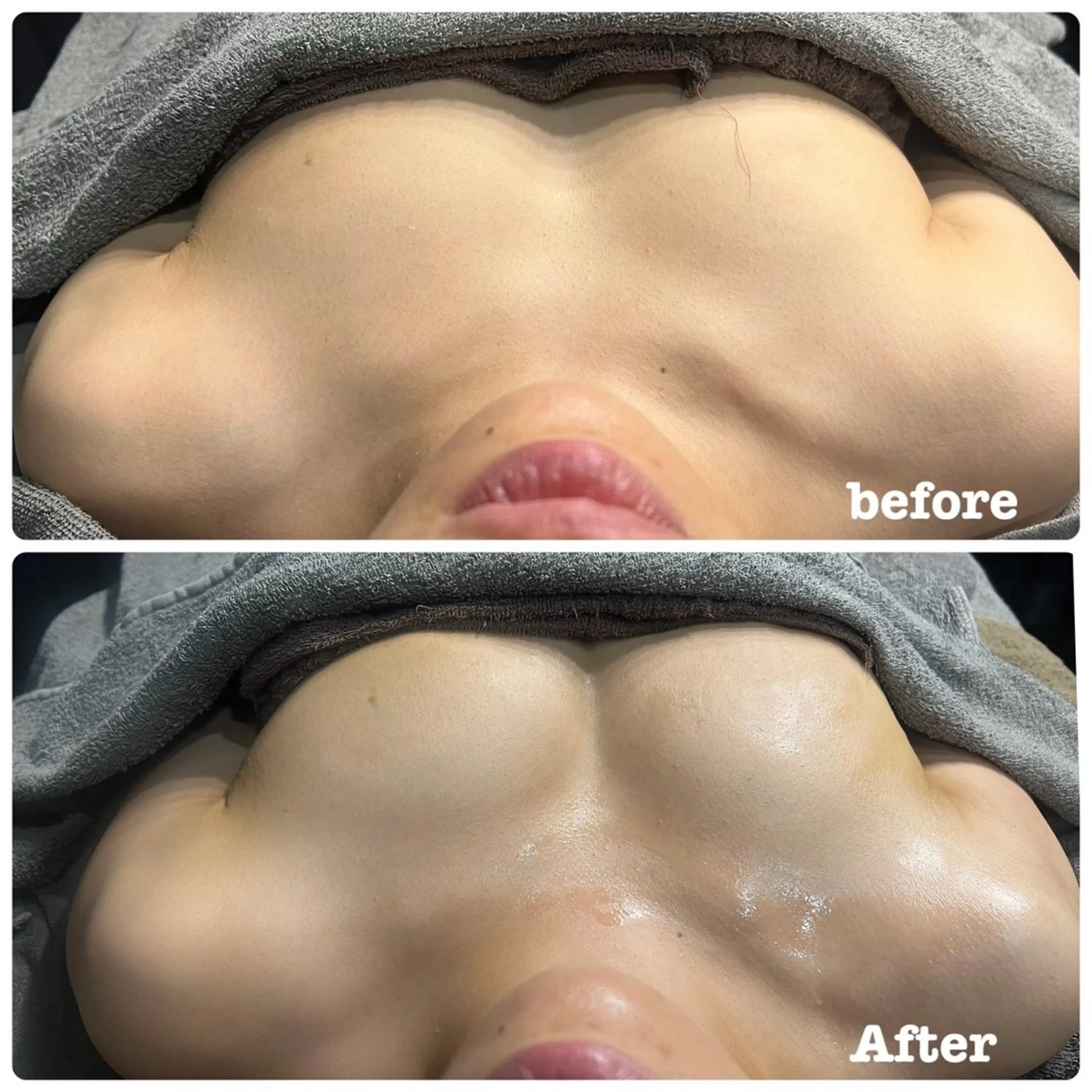 エステ Salon de CocoFranのその他イメージ