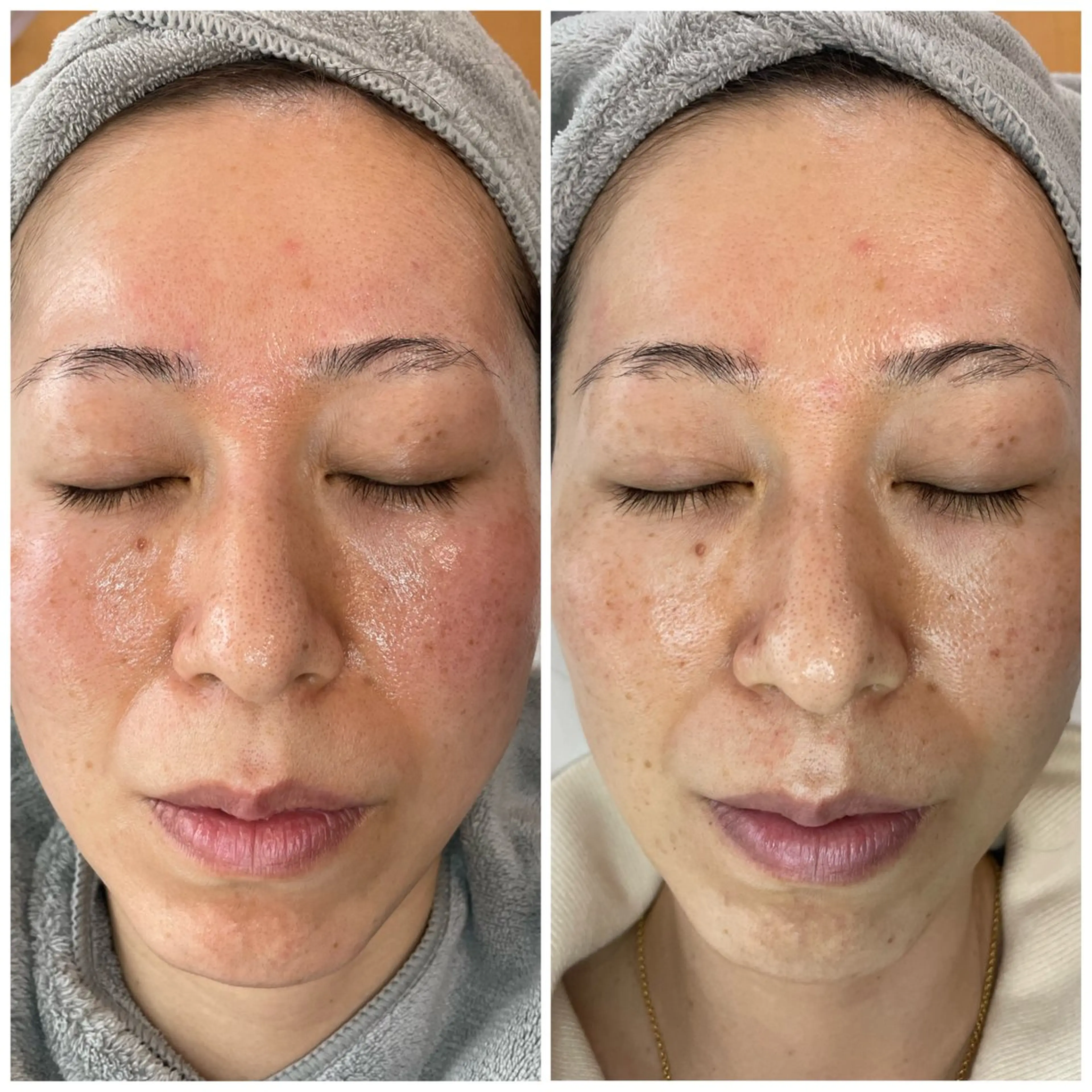 サロンピュア 所沢店のエステ・リラクイメージ