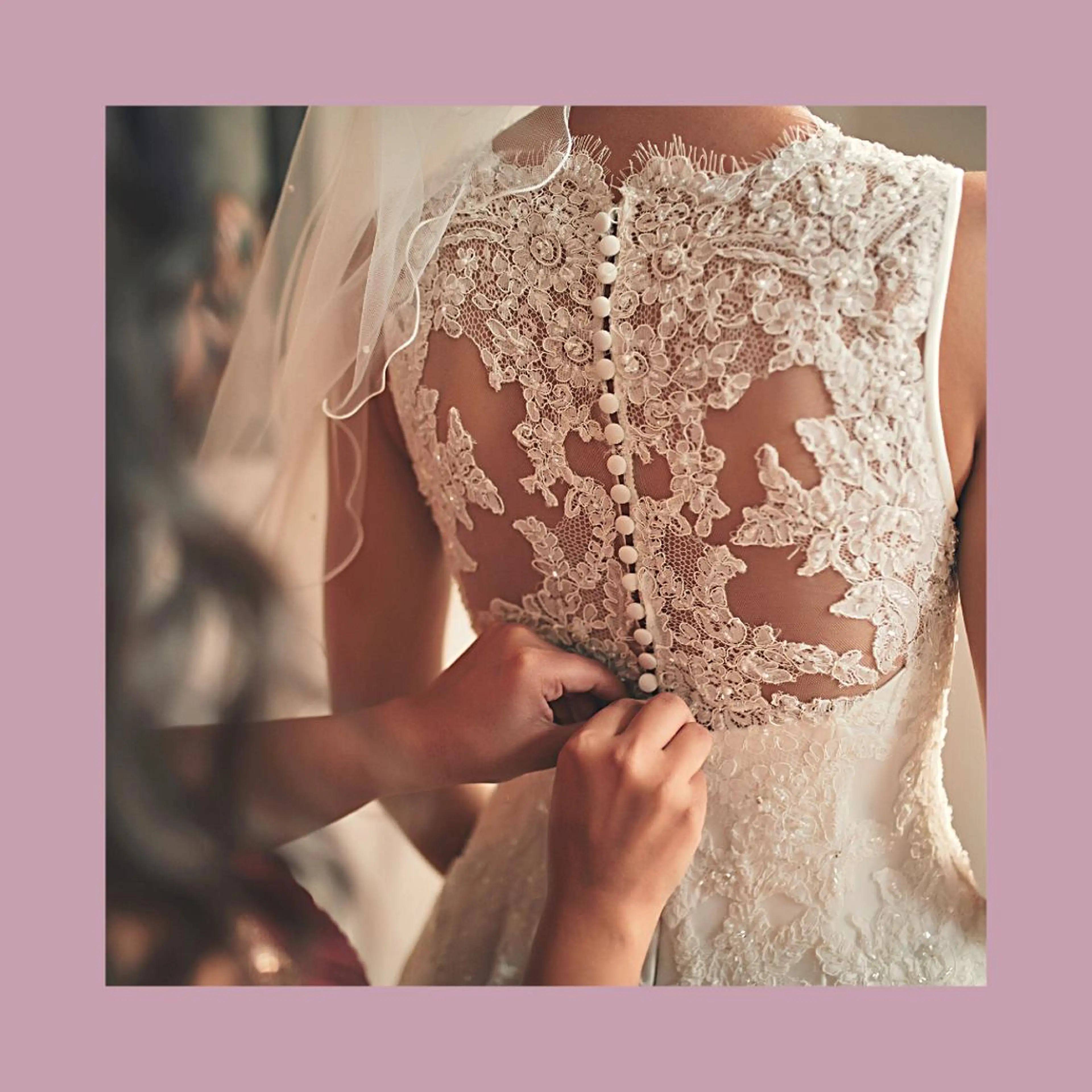 【ブライダル】お得◎お顔​〜​背中まで出るところ全部脱毛♪の写真