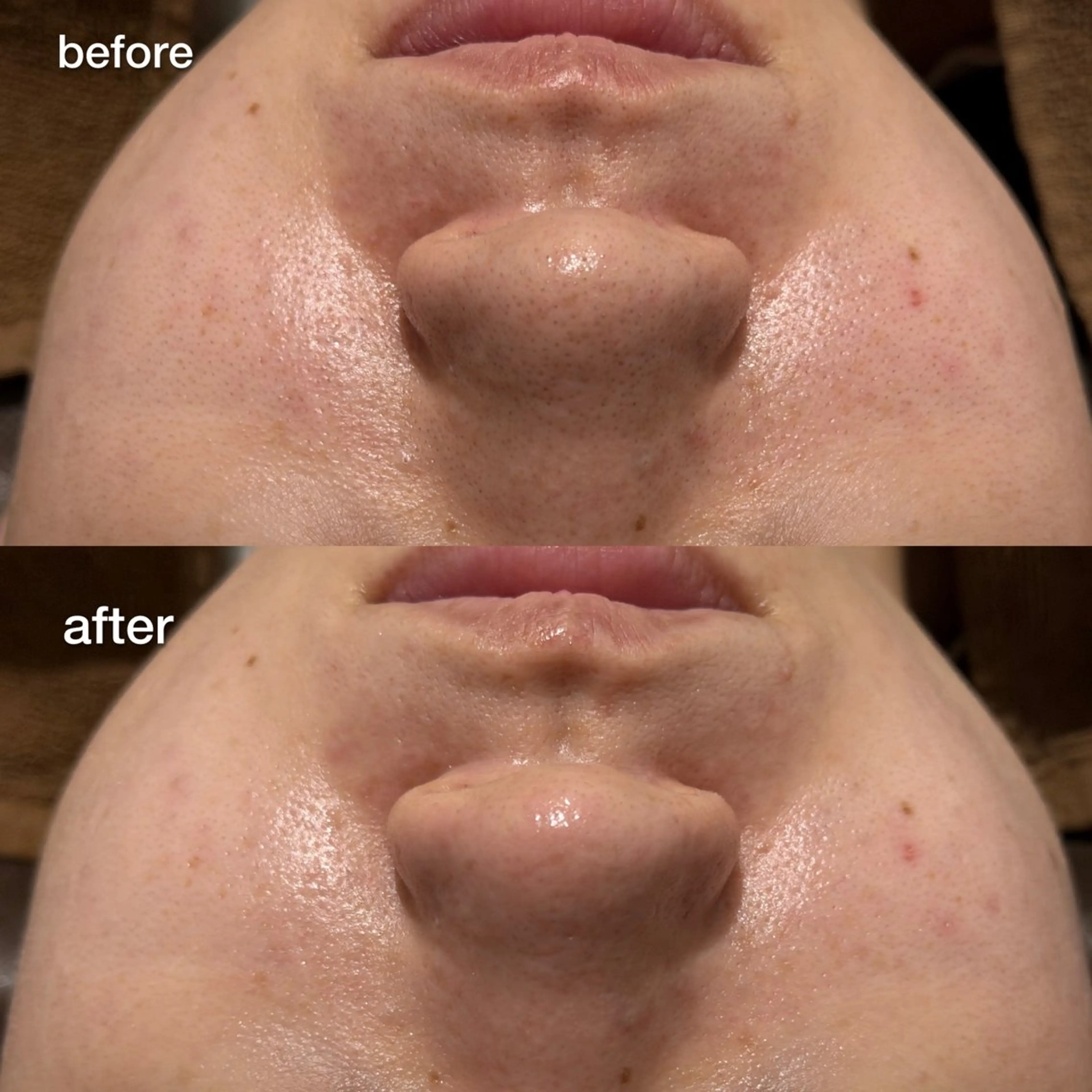 エステ ENCHANT Kaede/肌質改善のその他イメージ