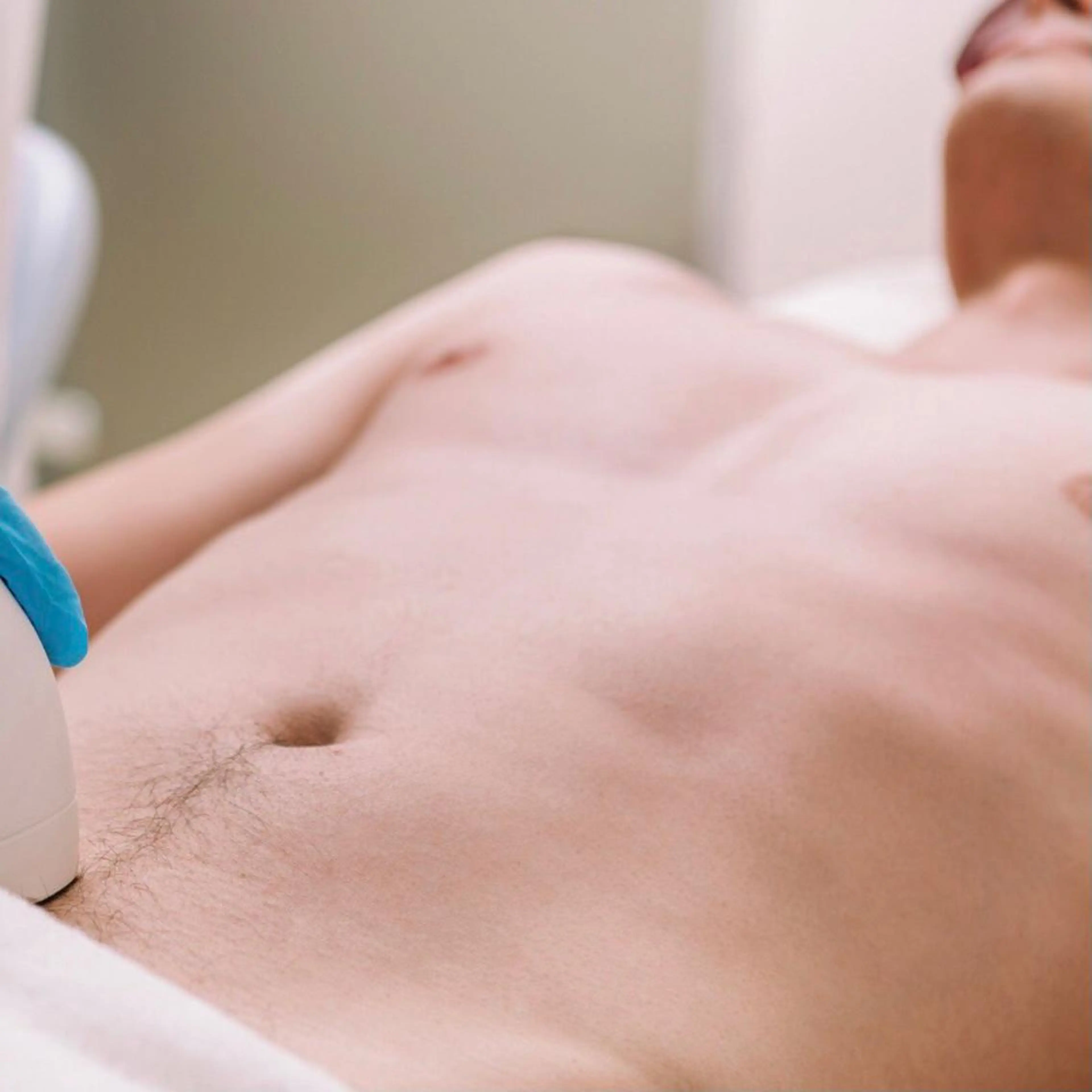 メンズ✨ハイブリッド全身脱毛(顔・VIO有)の写真