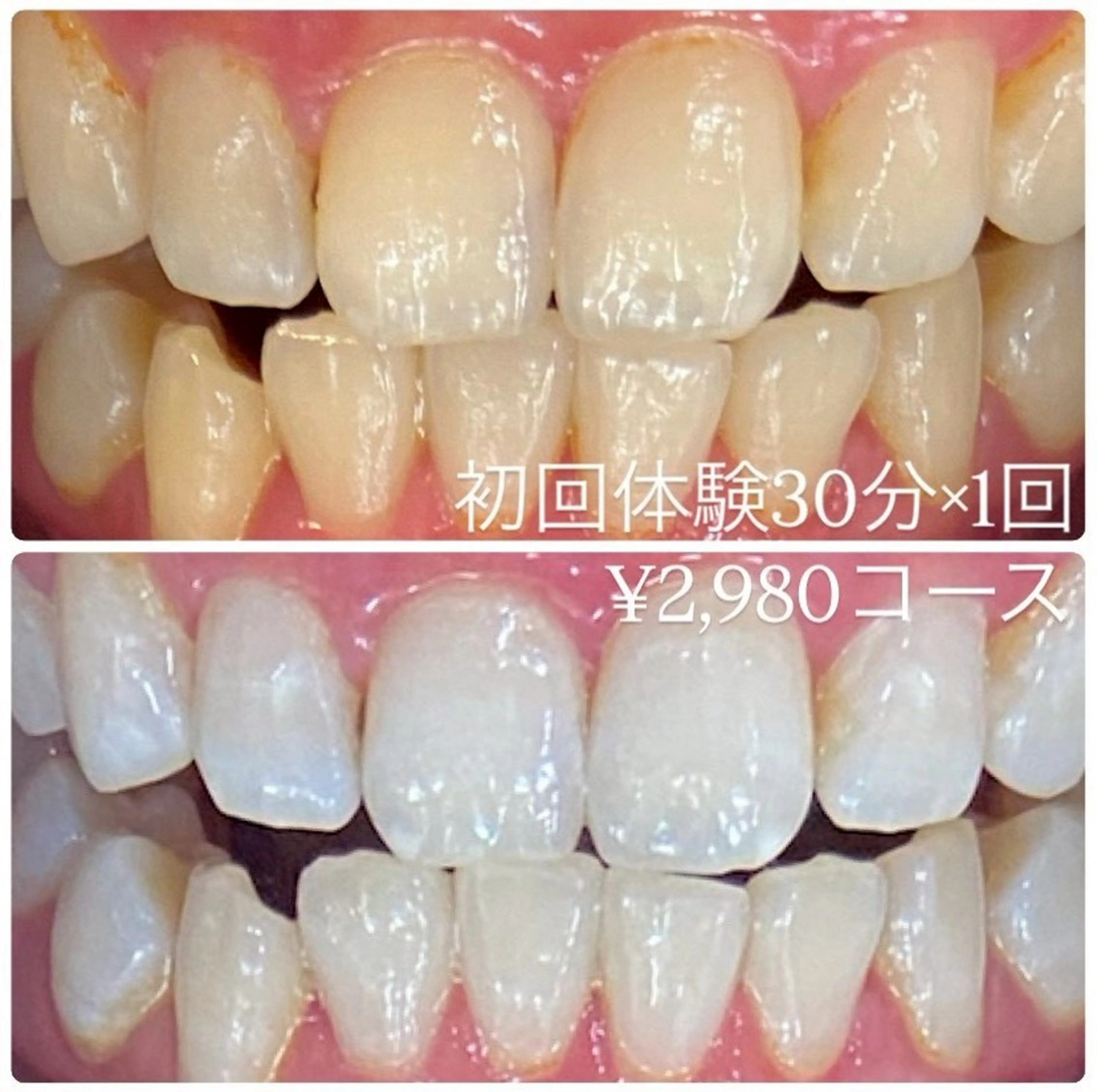 メンズ ホワイトニング ルーム　川崎店のその他イメージ