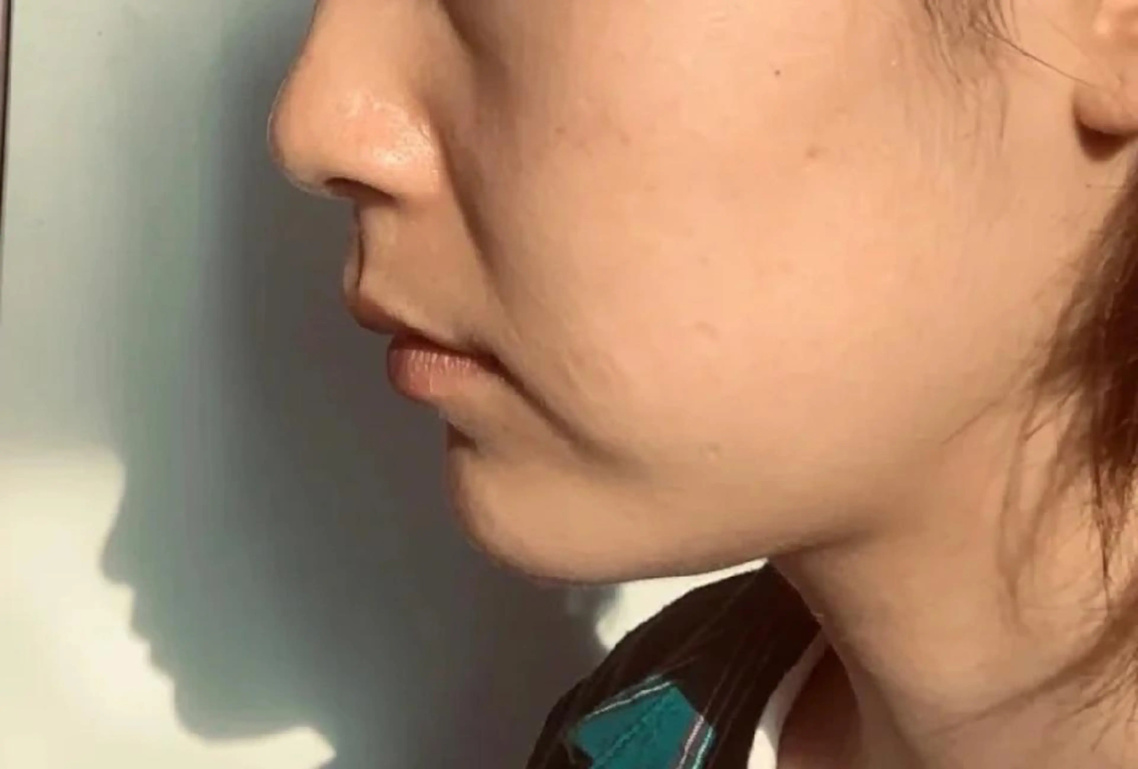 エステ aliaハーブ水光店 エステティシャン募集のエステ・リラクイメージ