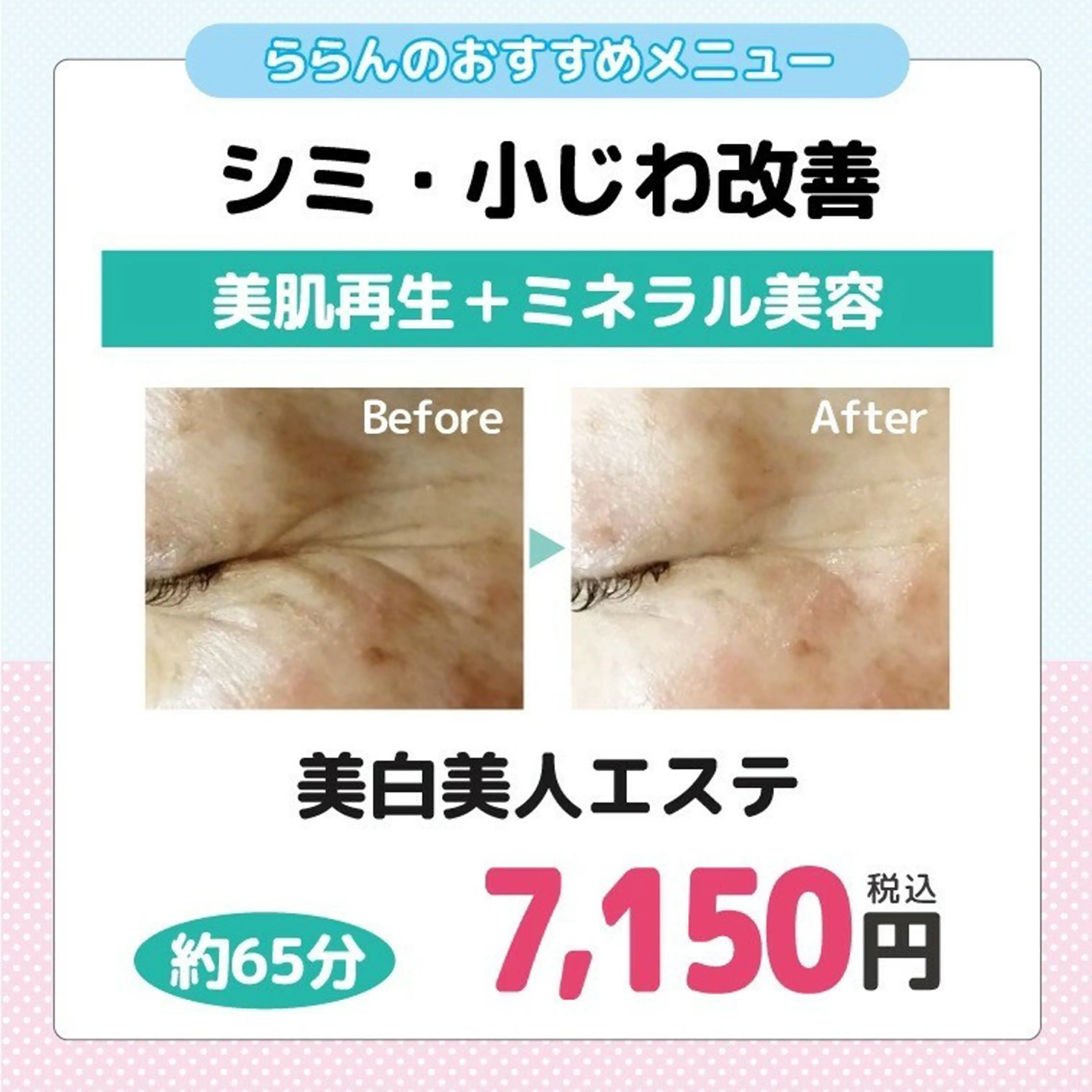 👑おまかせセット💞【美白美人エステ】の写真