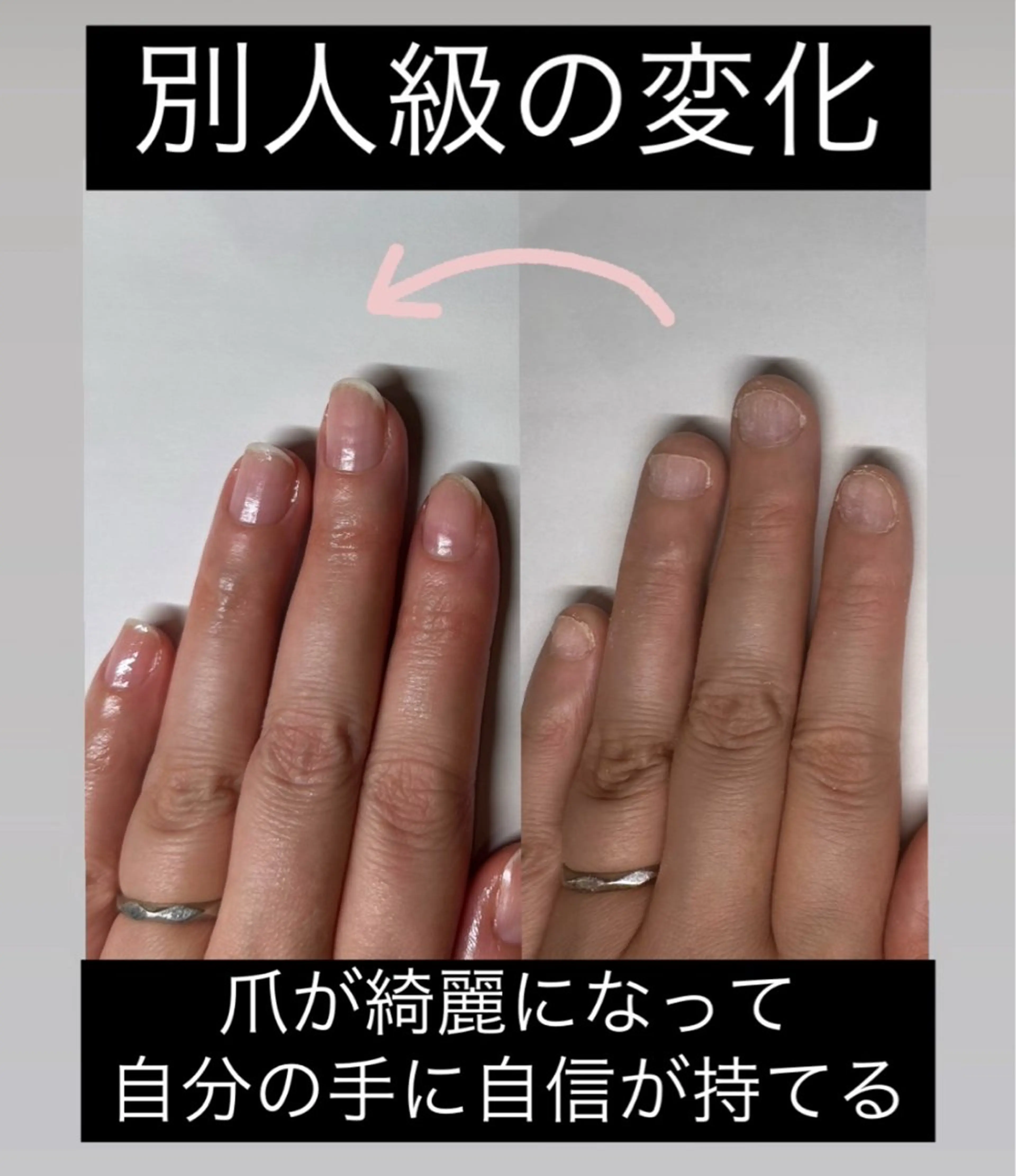 ネイル 深爪矯正専門店 ネイルサロンKUUのネイルデザイン