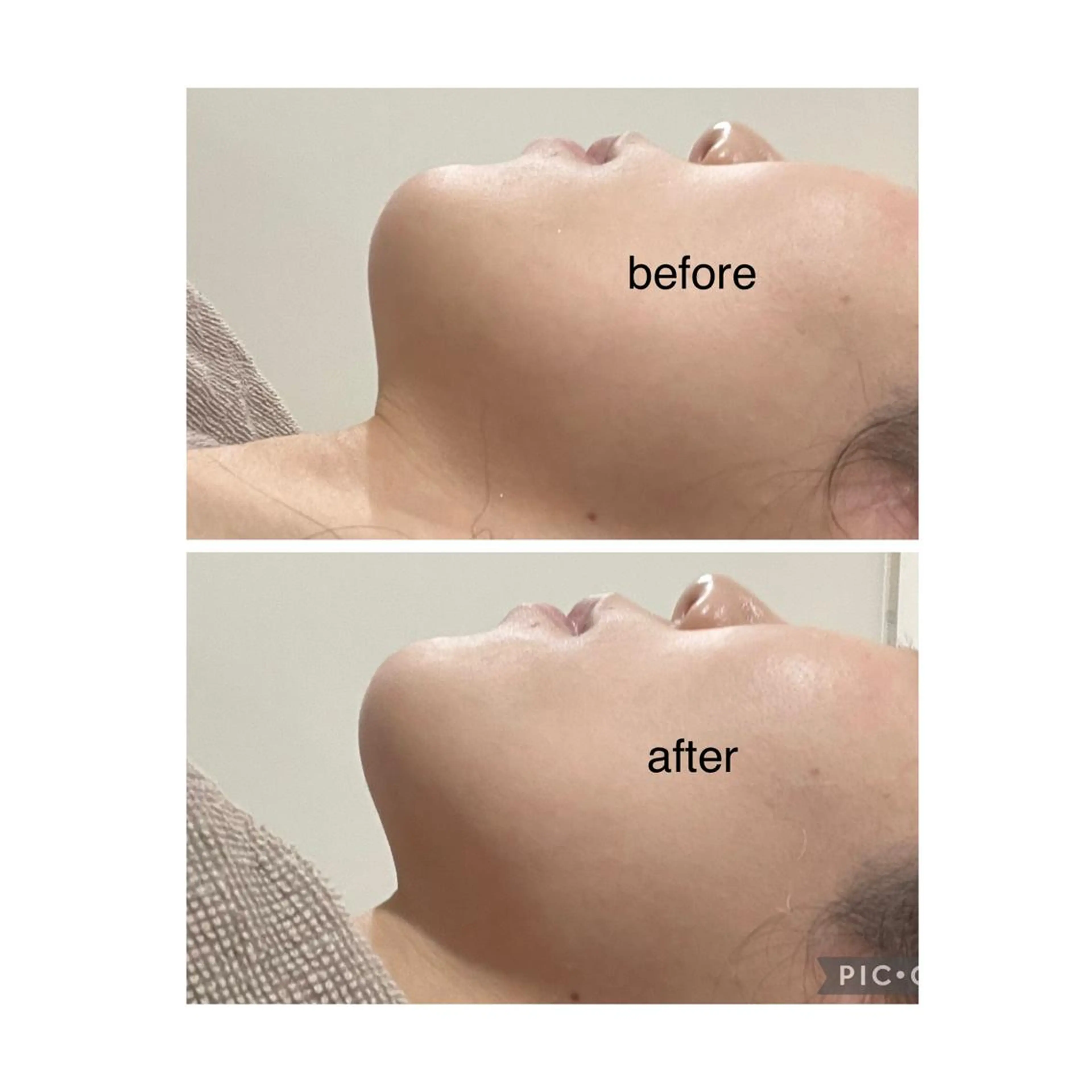 エステ 脱毛/痩身/頭皮ケア GLYCINEのエステ・リラクイメージ