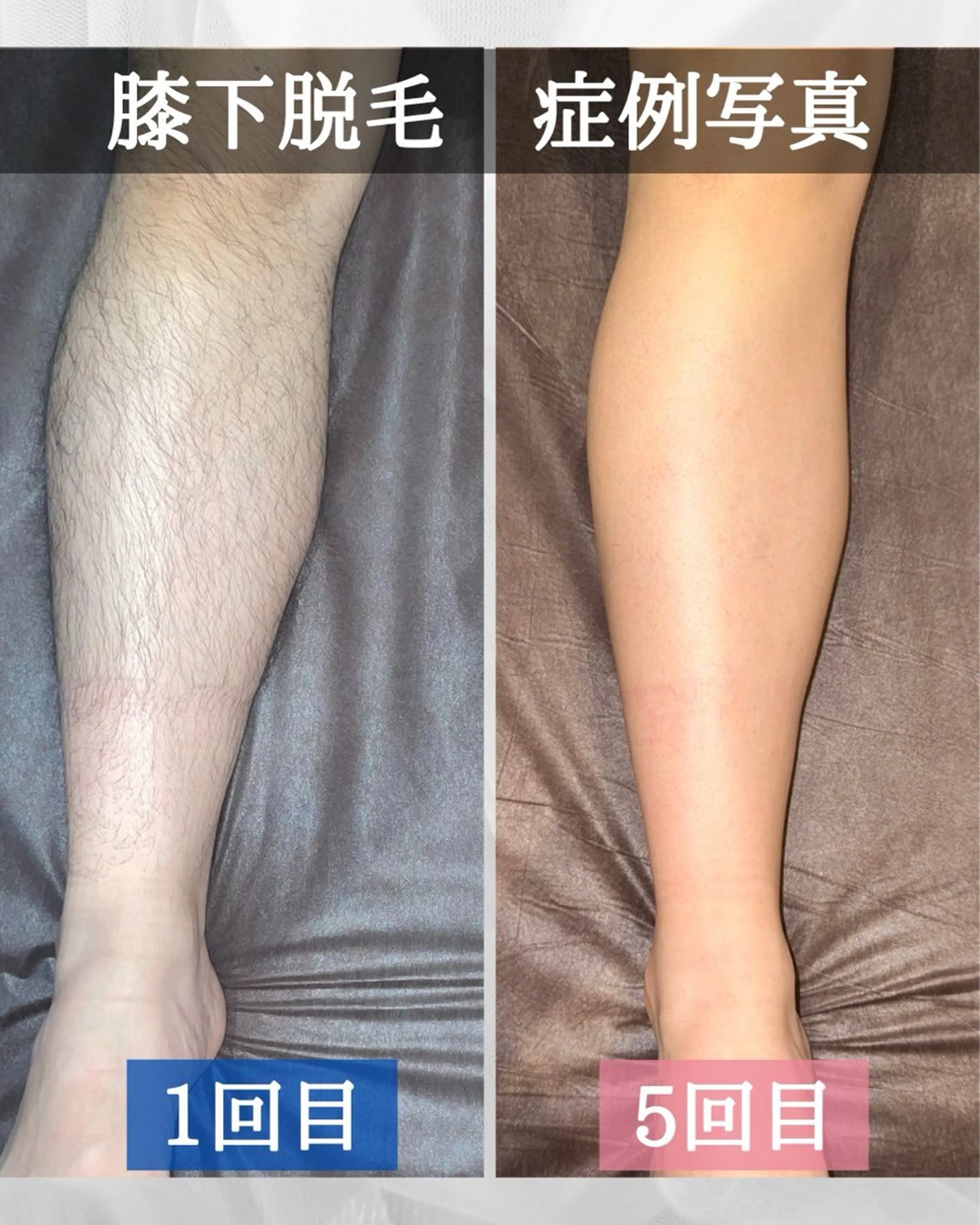 メンズ MEN'S SALON glow所属・メンズ脱毛 glow 中目黒のエステ・リラクイメージ