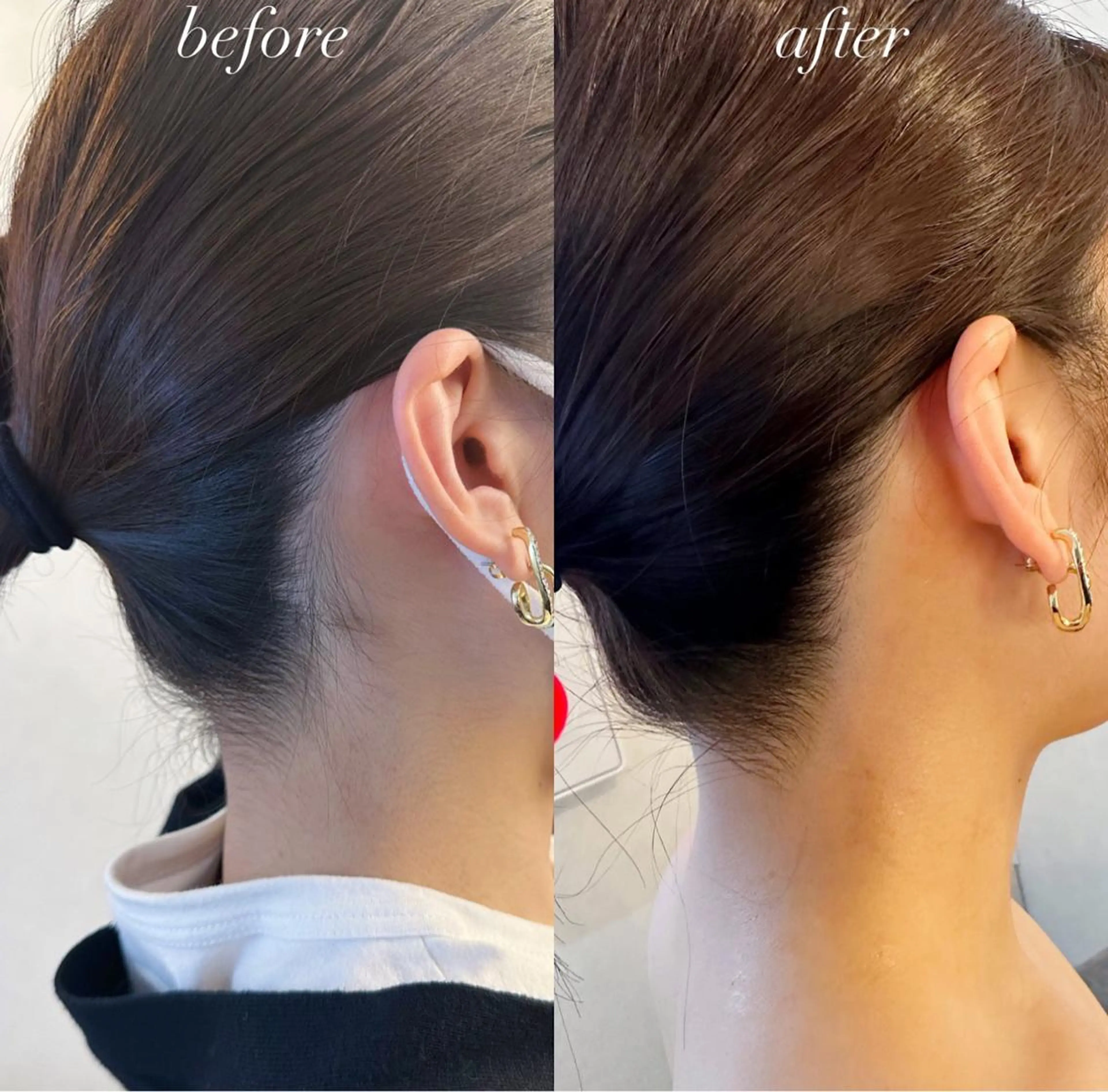 うなじ脱毛/美肌脱毛 LABELのエステ・リラクイメージ