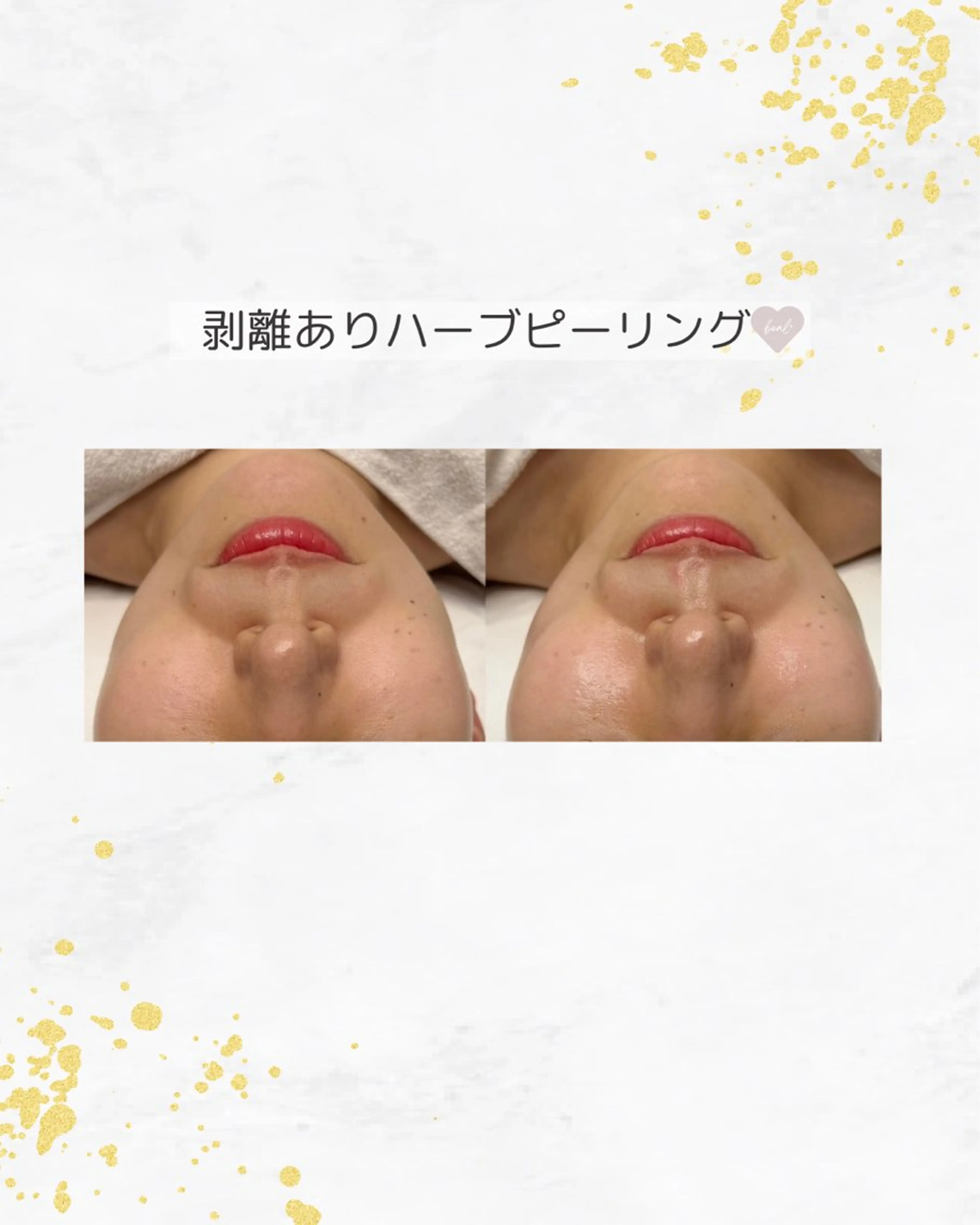 小顔/毛穴/ニキビ salon bealのエステ・リラクイメージ