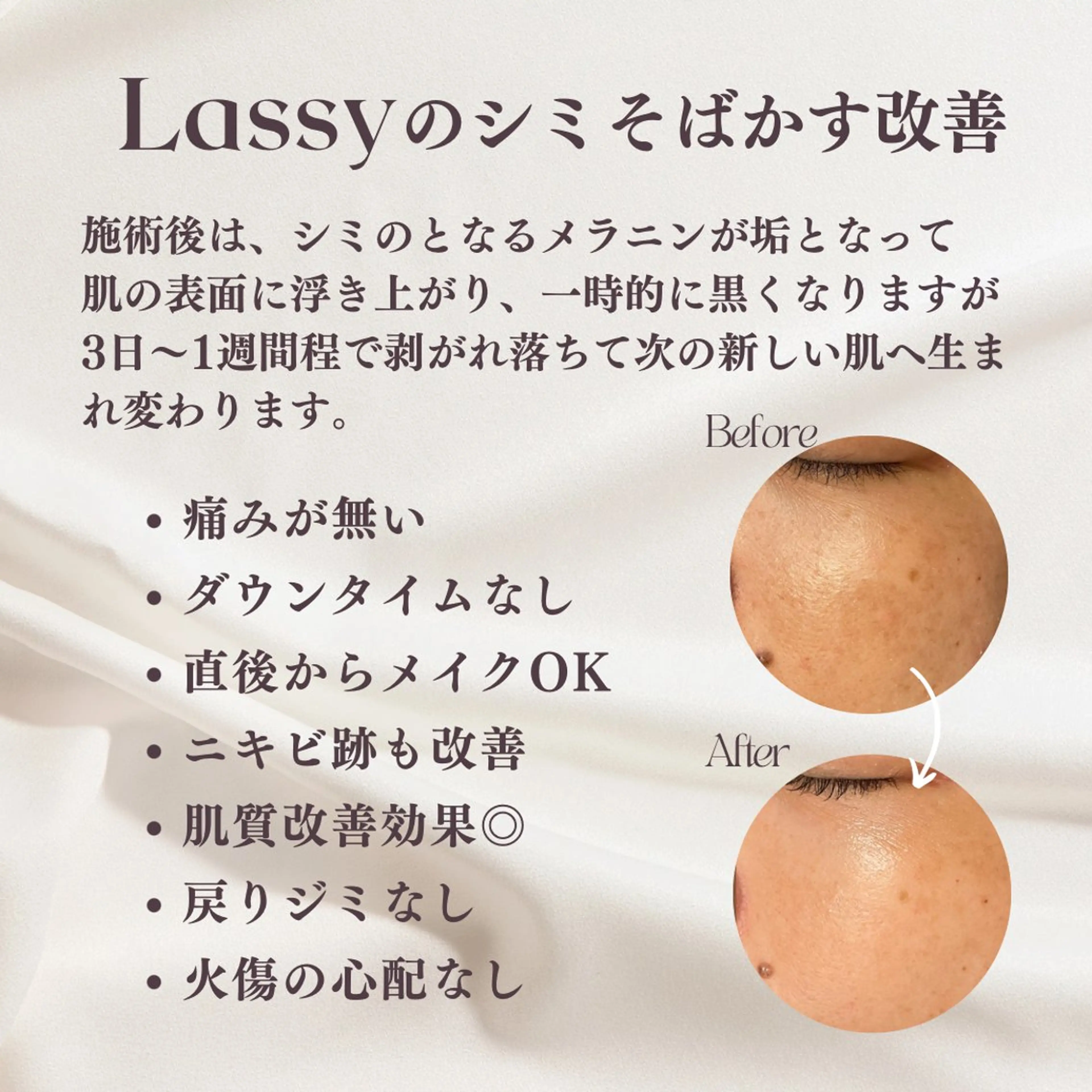 エステ Lassy Yuriの眉毛・アイブロウイメージ