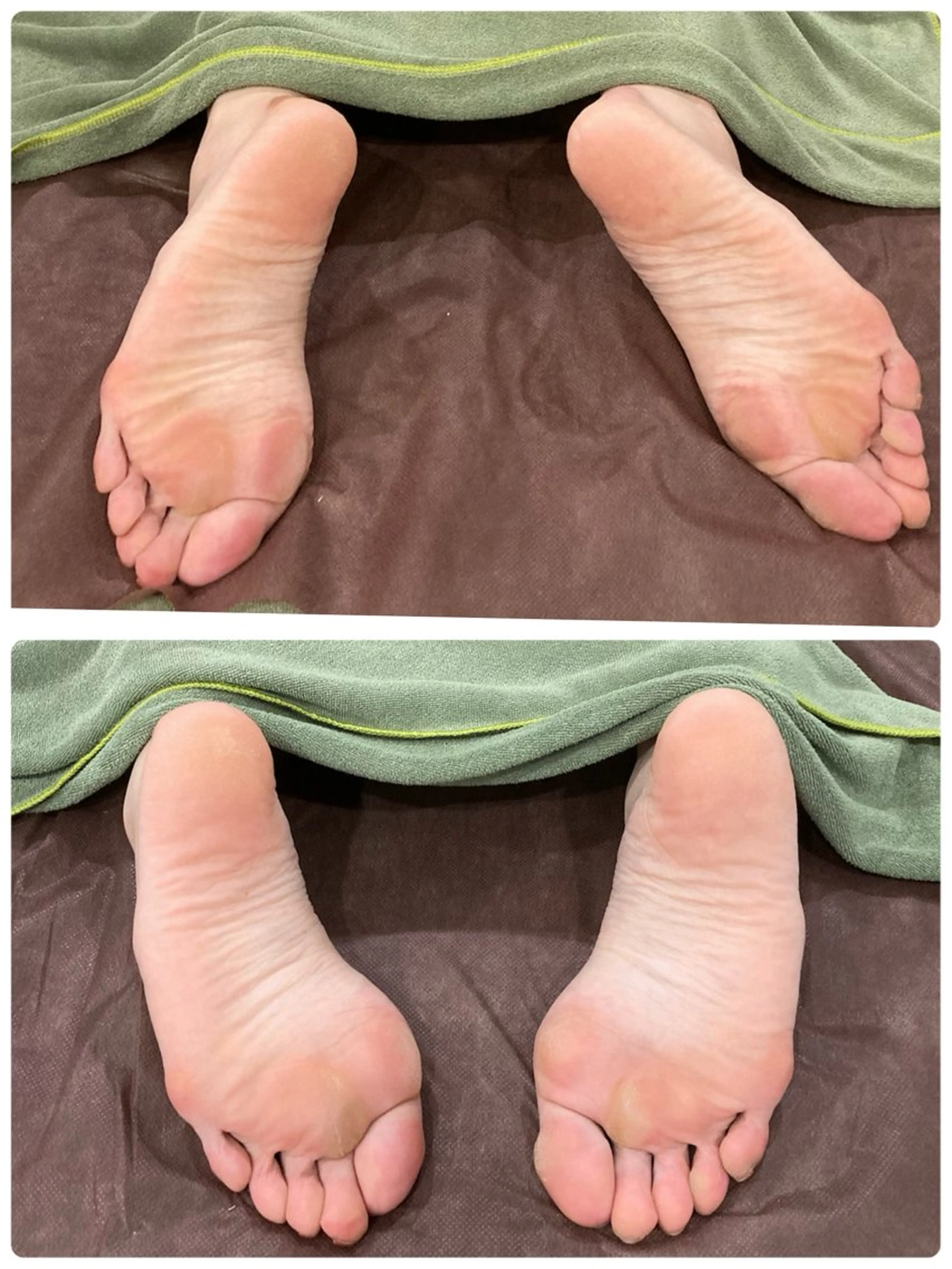 レインドロップ施術90分の写真