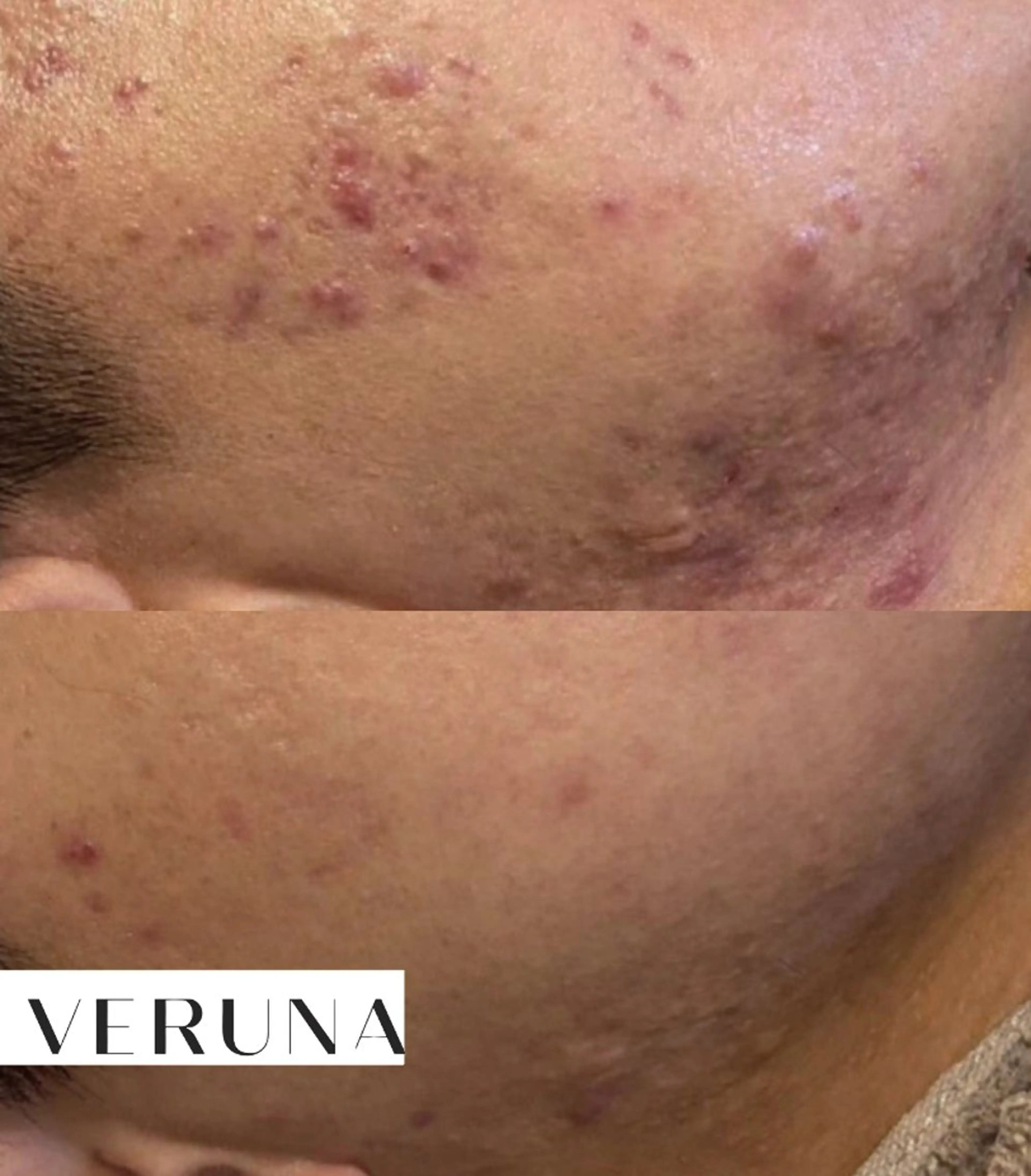 メンズ ハーブピーリング専門 葵/LUNEAのエステ・リラクイメージ