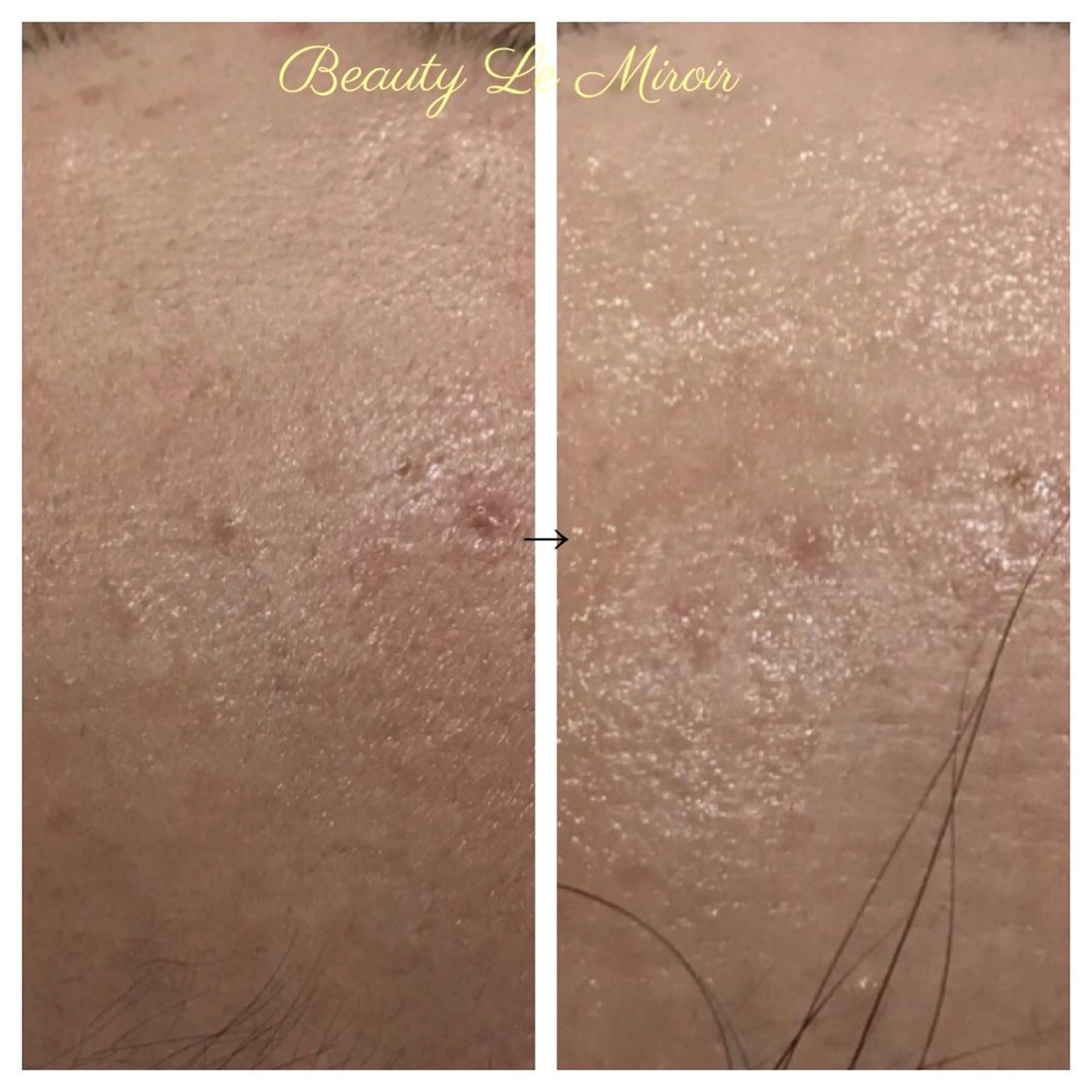 ビューティー ミロワールのエステ・リラクイメージ