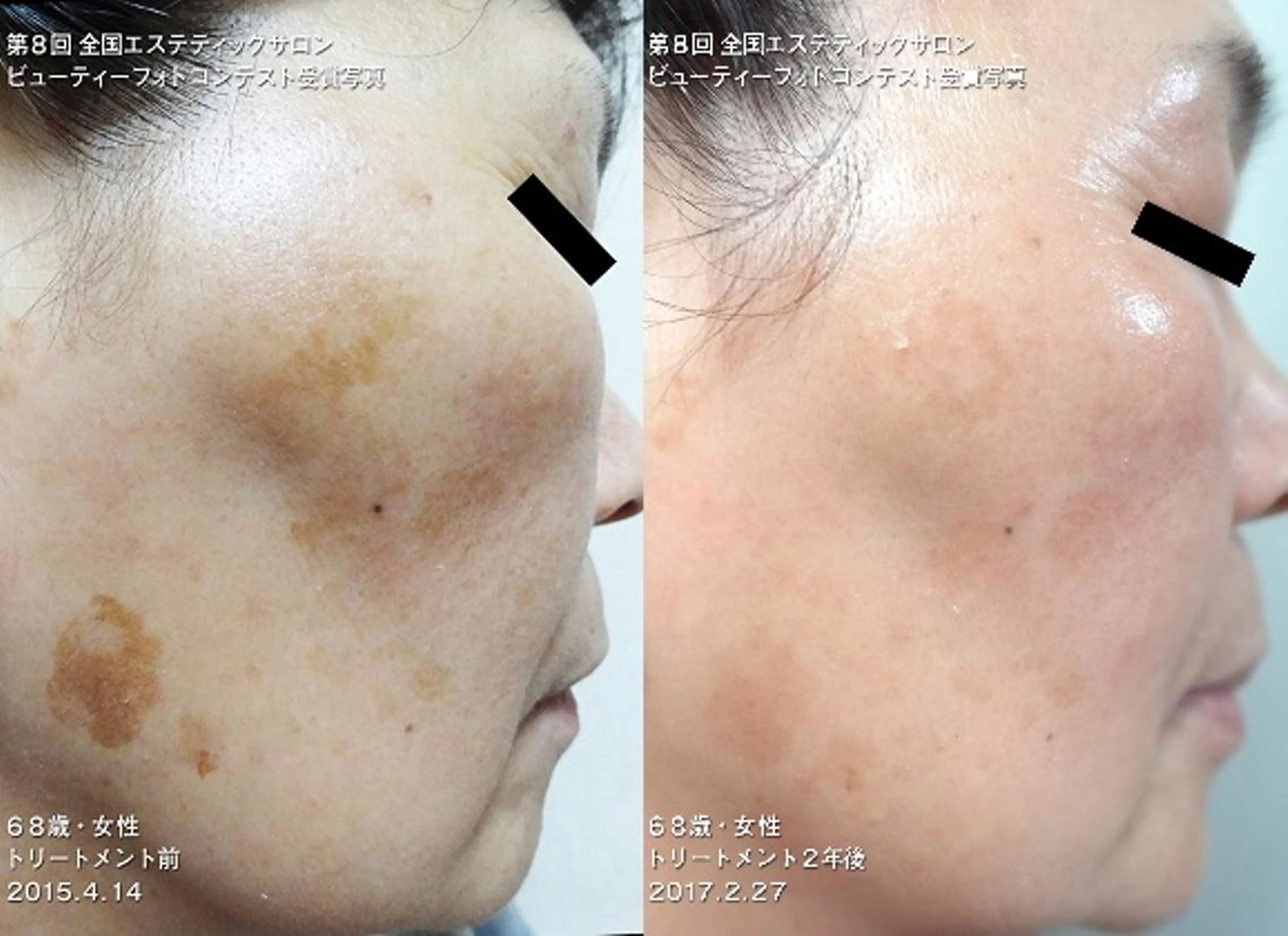 藤江 真弓のエステ・リラクイメージ