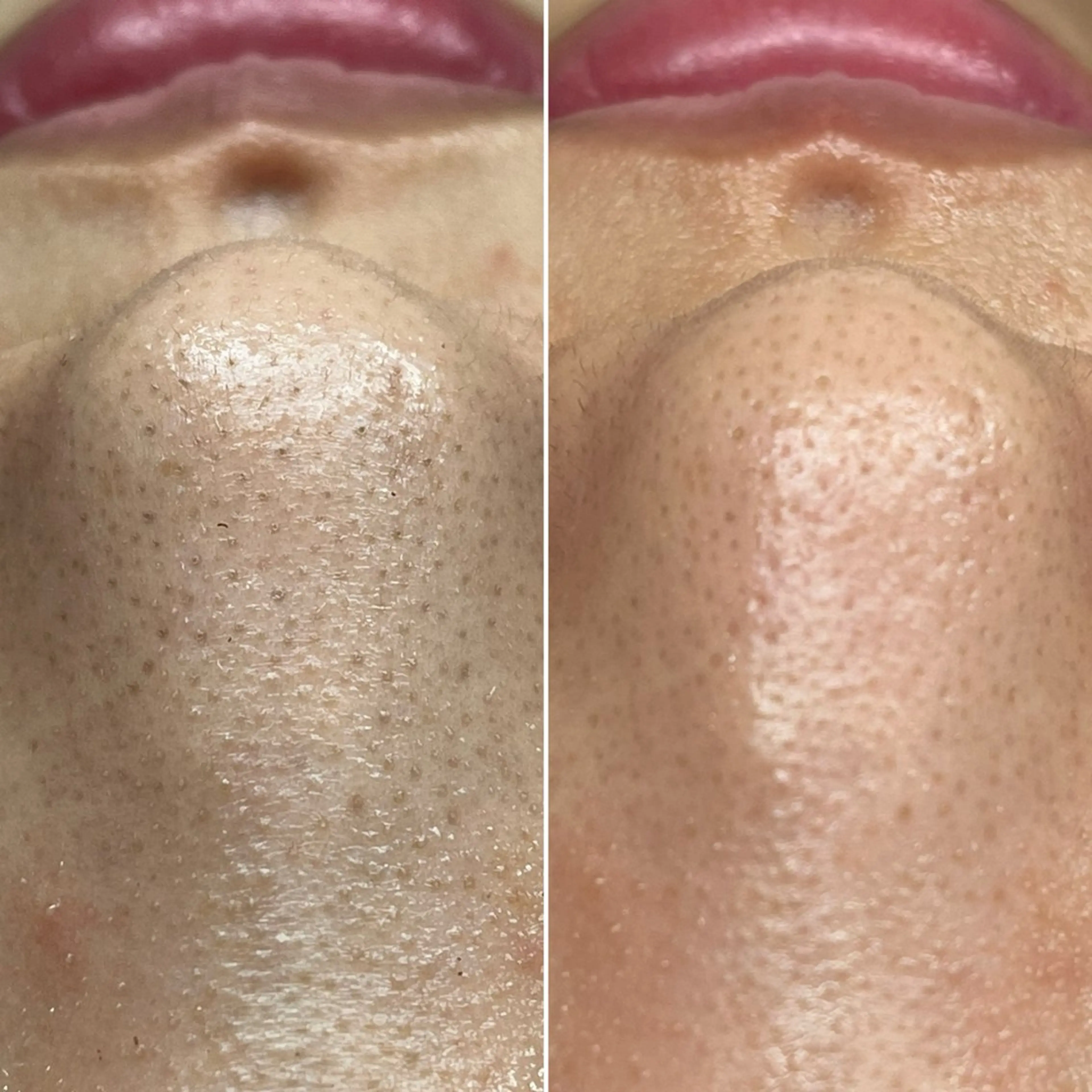 Blue Moon 【ブルームーン】のエステ・リラクイメージ