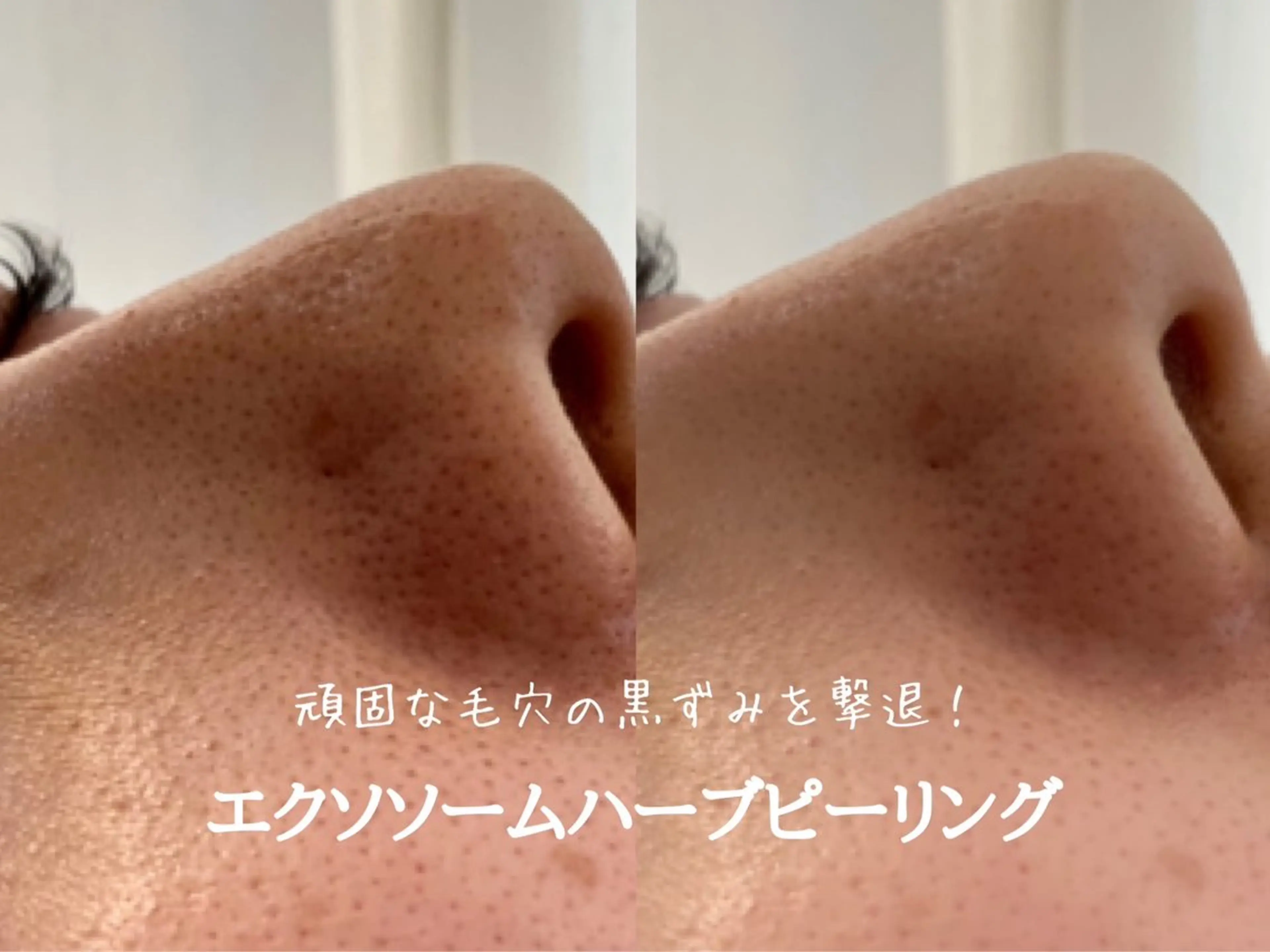 最速小顔・肌質管理 espoirマキのエステ・リラクイメージ