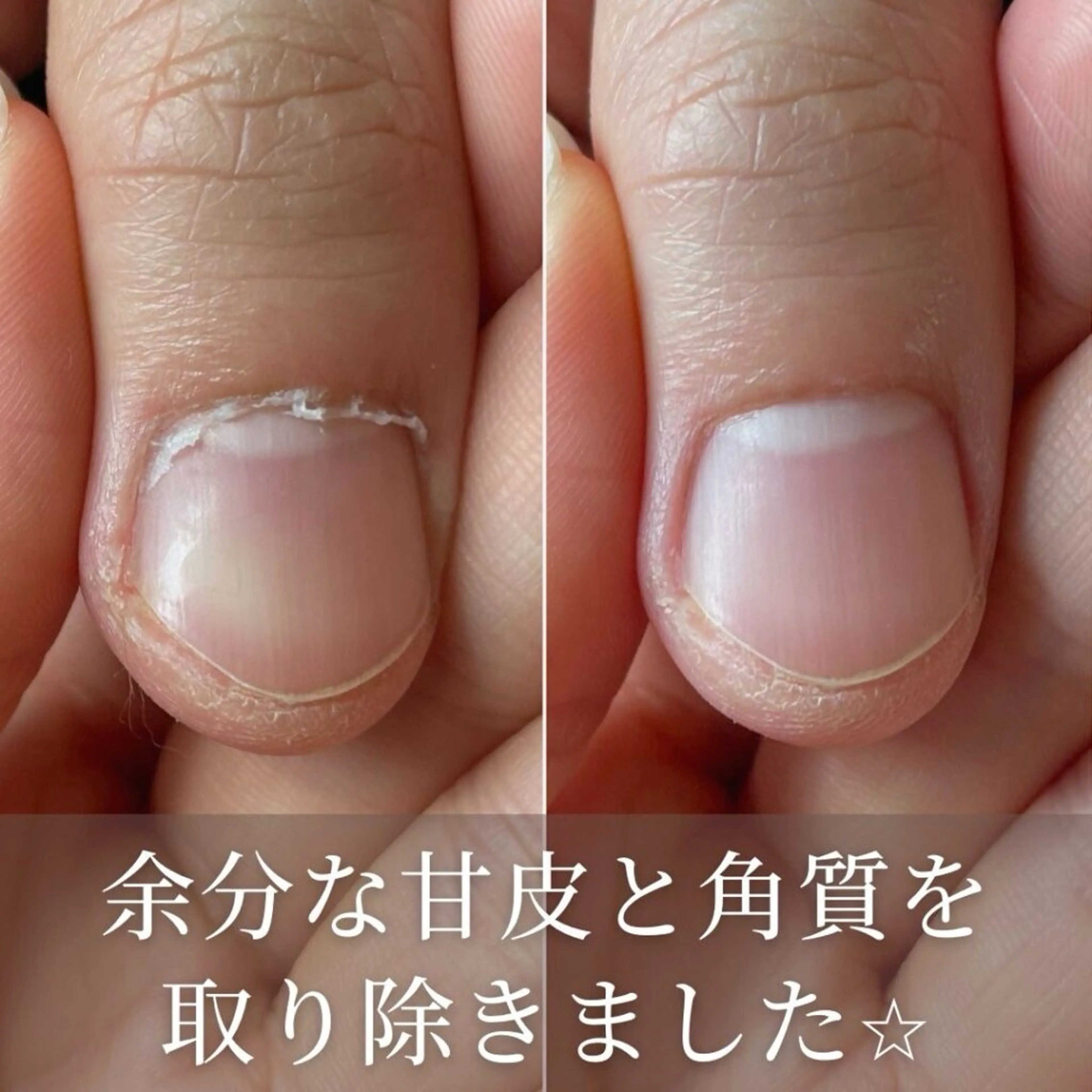 ネイル GENTY men'snailのネイルデザイン